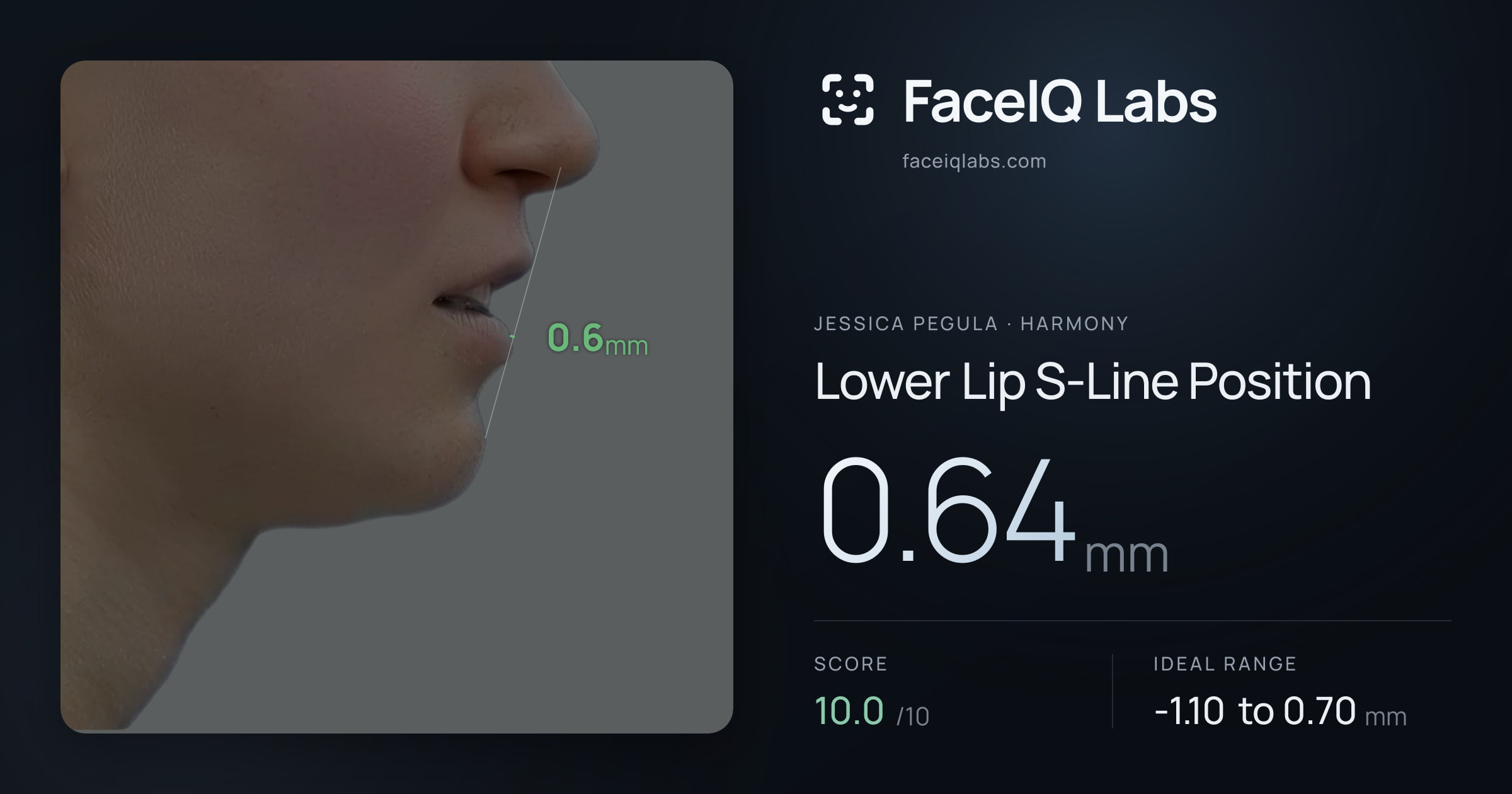 Jessica Pegula Lower Lip S-Line Position: 0.64mm, drawn on the photo