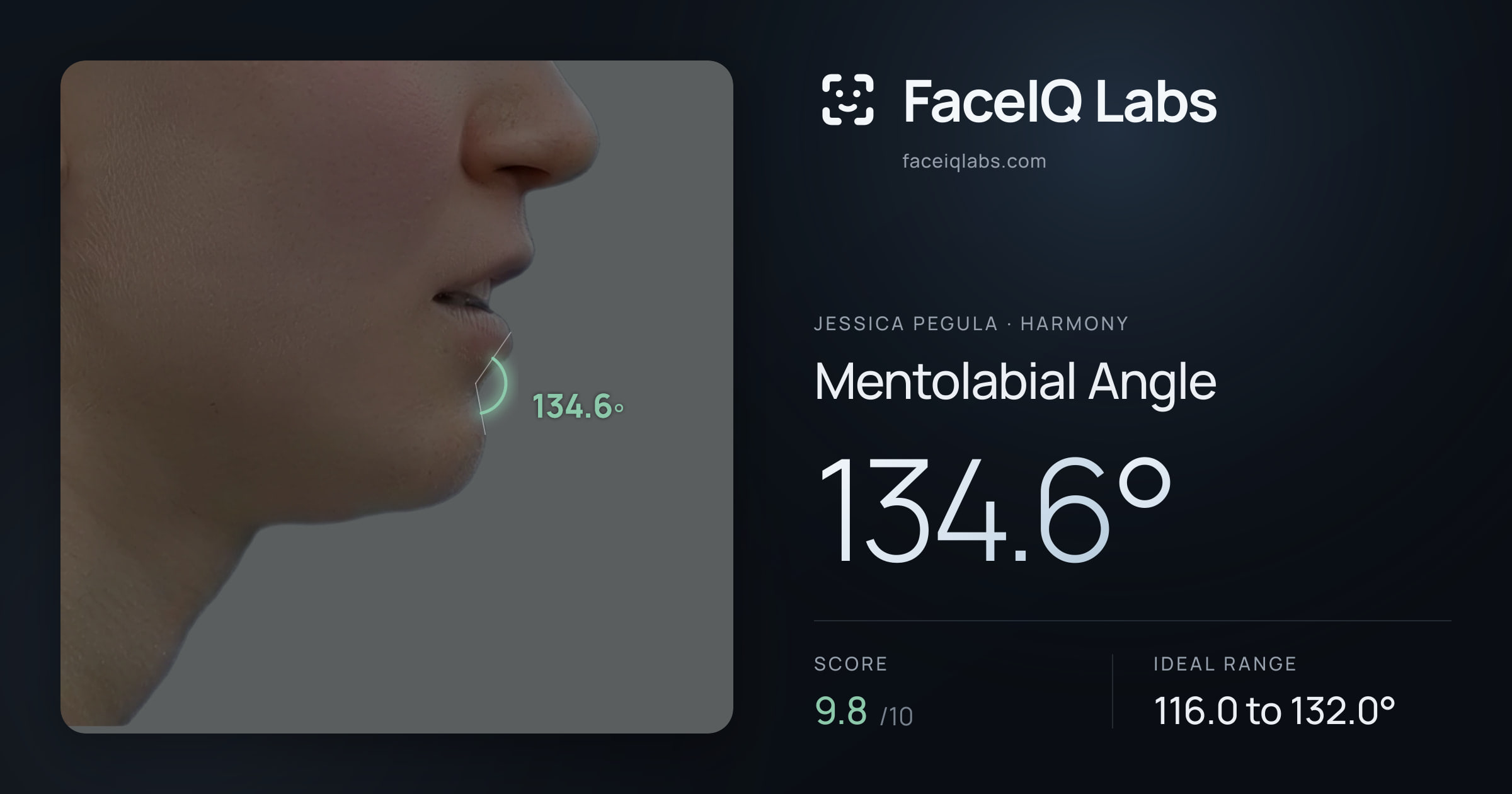 Jessica Pegula Mentolabial Angle: 134.6°, drawn on the photo