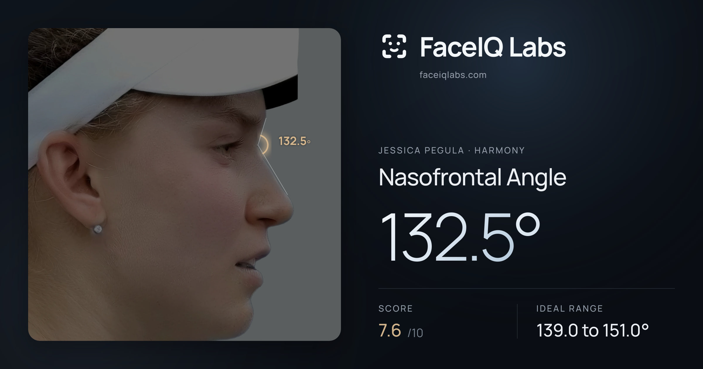 Jessica Pegula Nasofrontal Angle: 132.5°, drawn on the photo