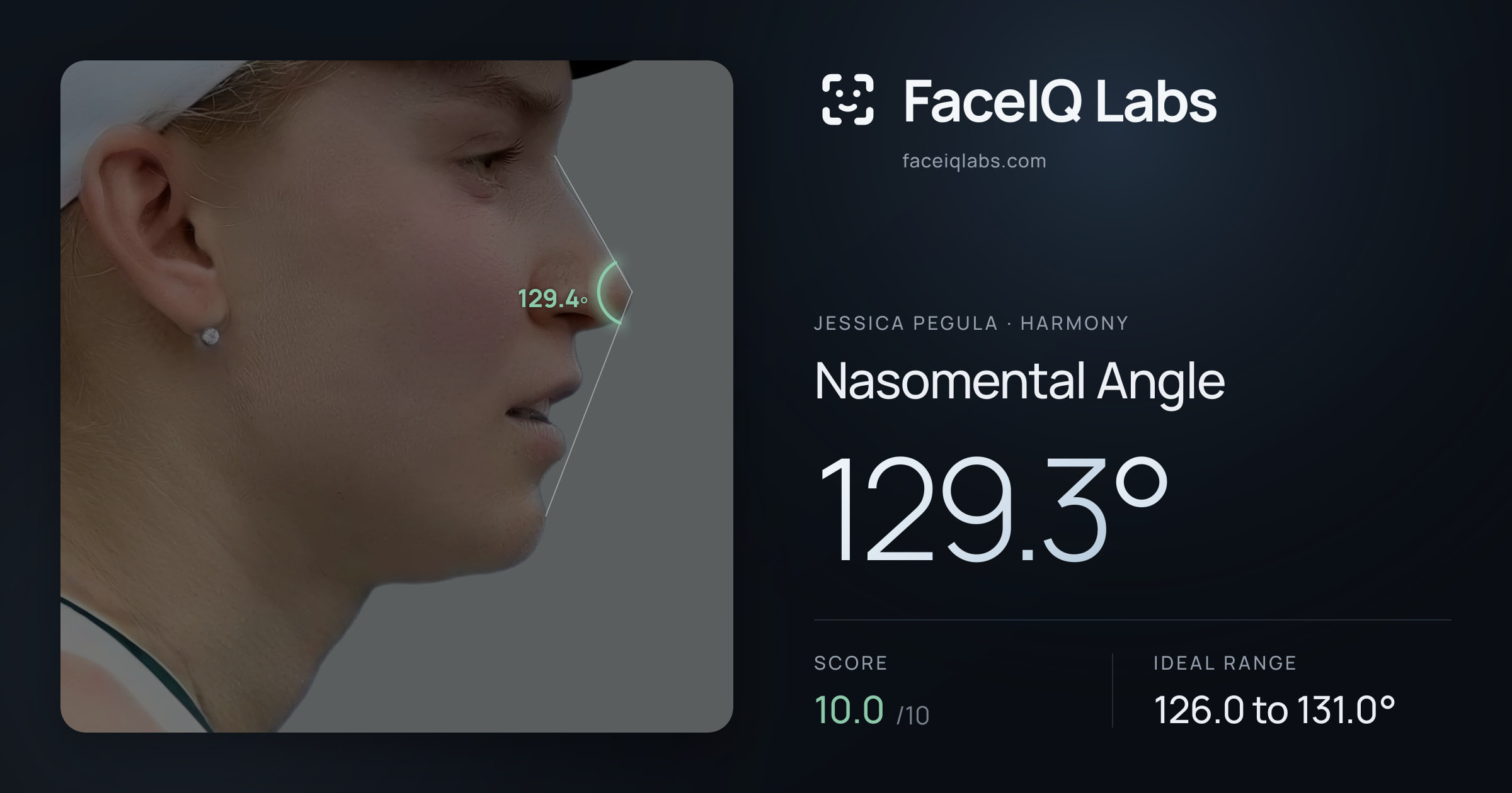 Jessica Pegula Nasomental Angle: 129.3°, drawn on the photo