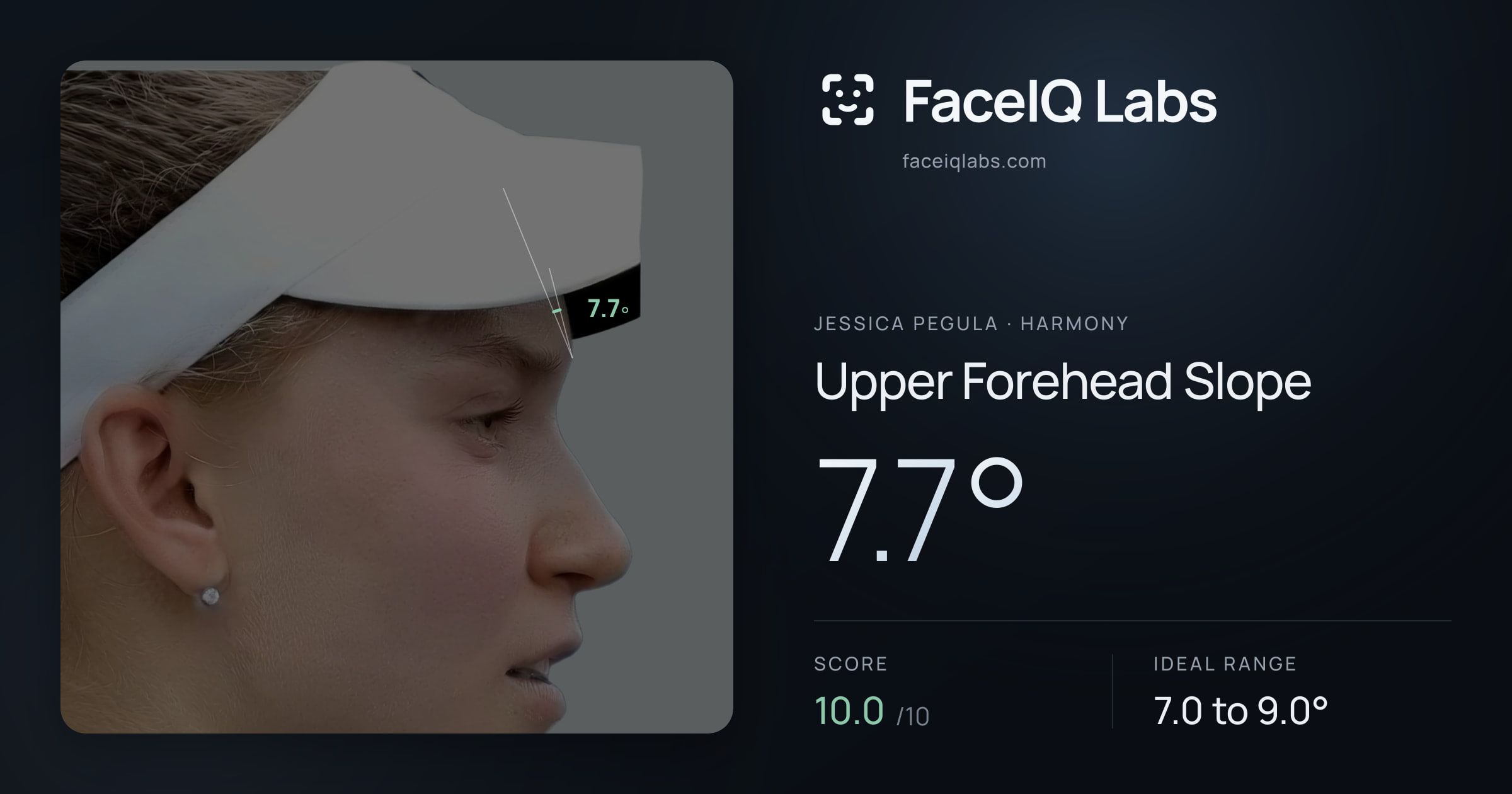 Jessica Pegula Upper Forehead Slope: 7.7°, drawn on the photo