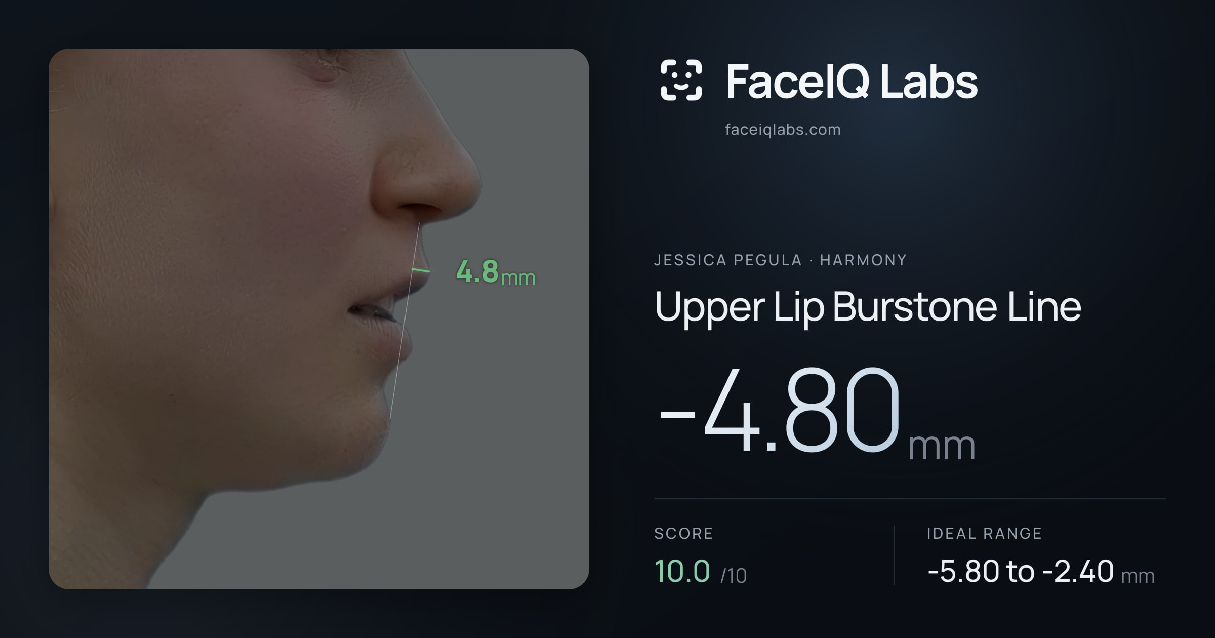 Jessica Pegula Upper Lip Burstone Line: -4.80mm, drawn on the photo