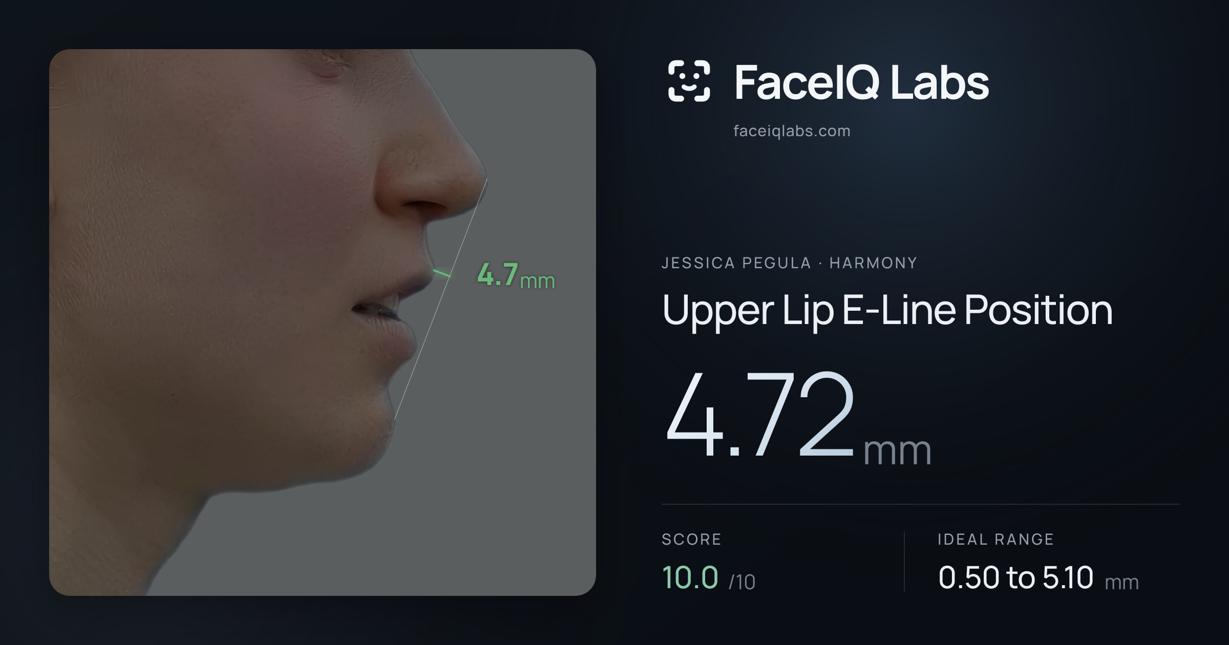 Jessica Pegula Upper Lip E-Line Position: 4.72mm, drawn on the photo
