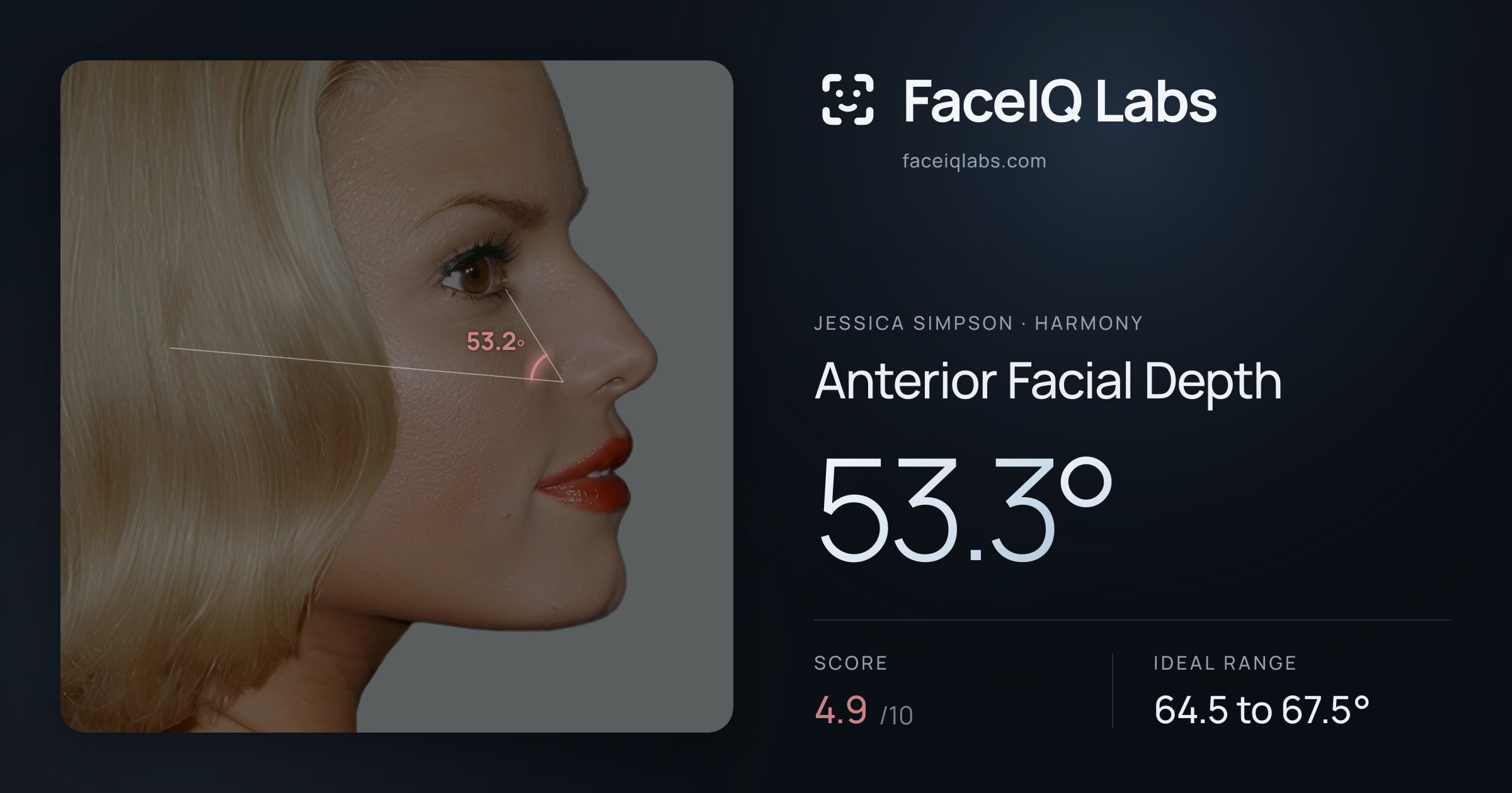 Jessica Simpson Anterior Facial Depth: 53.3°, drawn on the photo