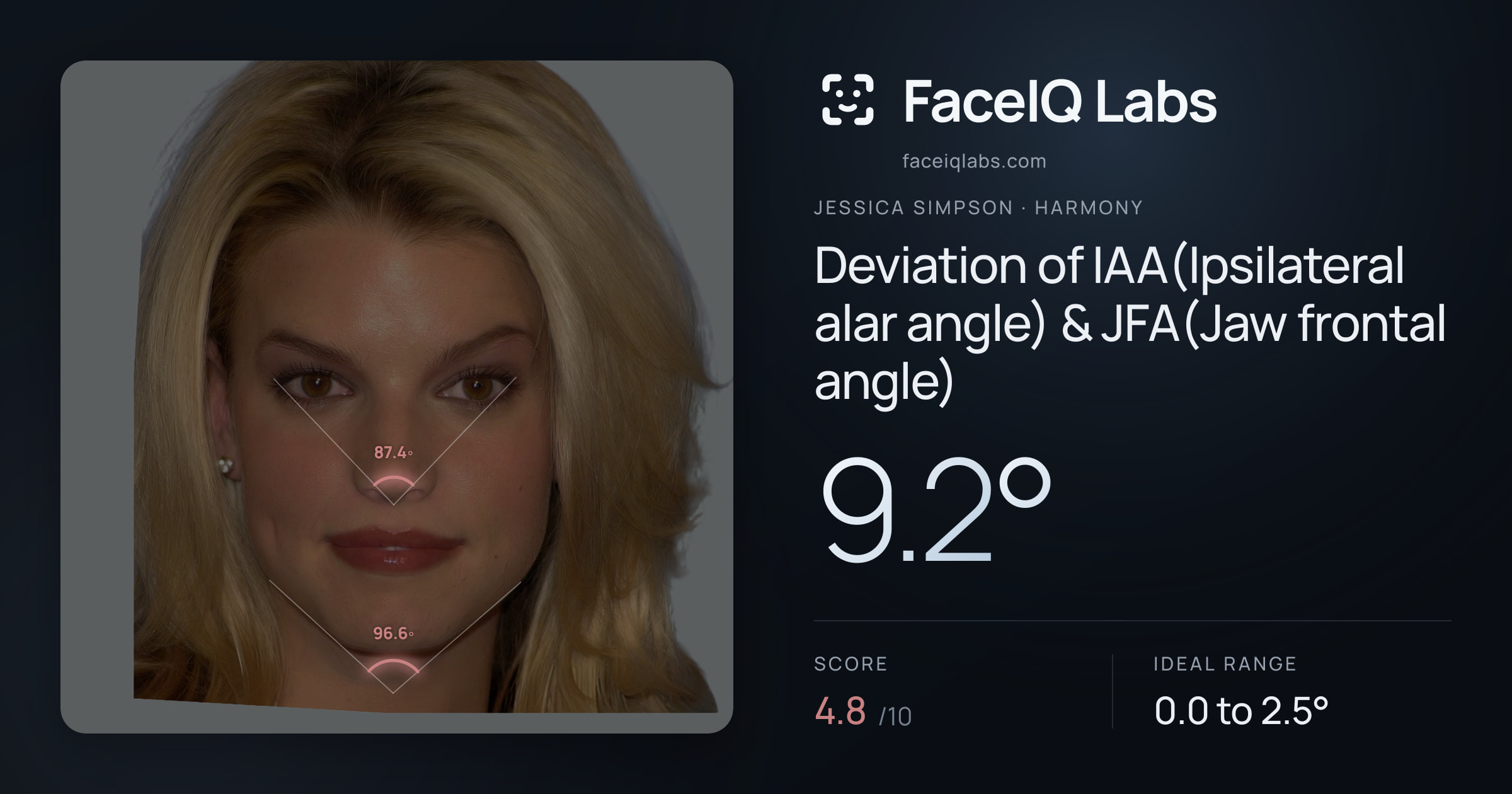 Jessica Simpson Deviation of IAA(Ipsilateral alar angle) & JFA(Jaw frontal angle): 9.2°, drawn on the photo