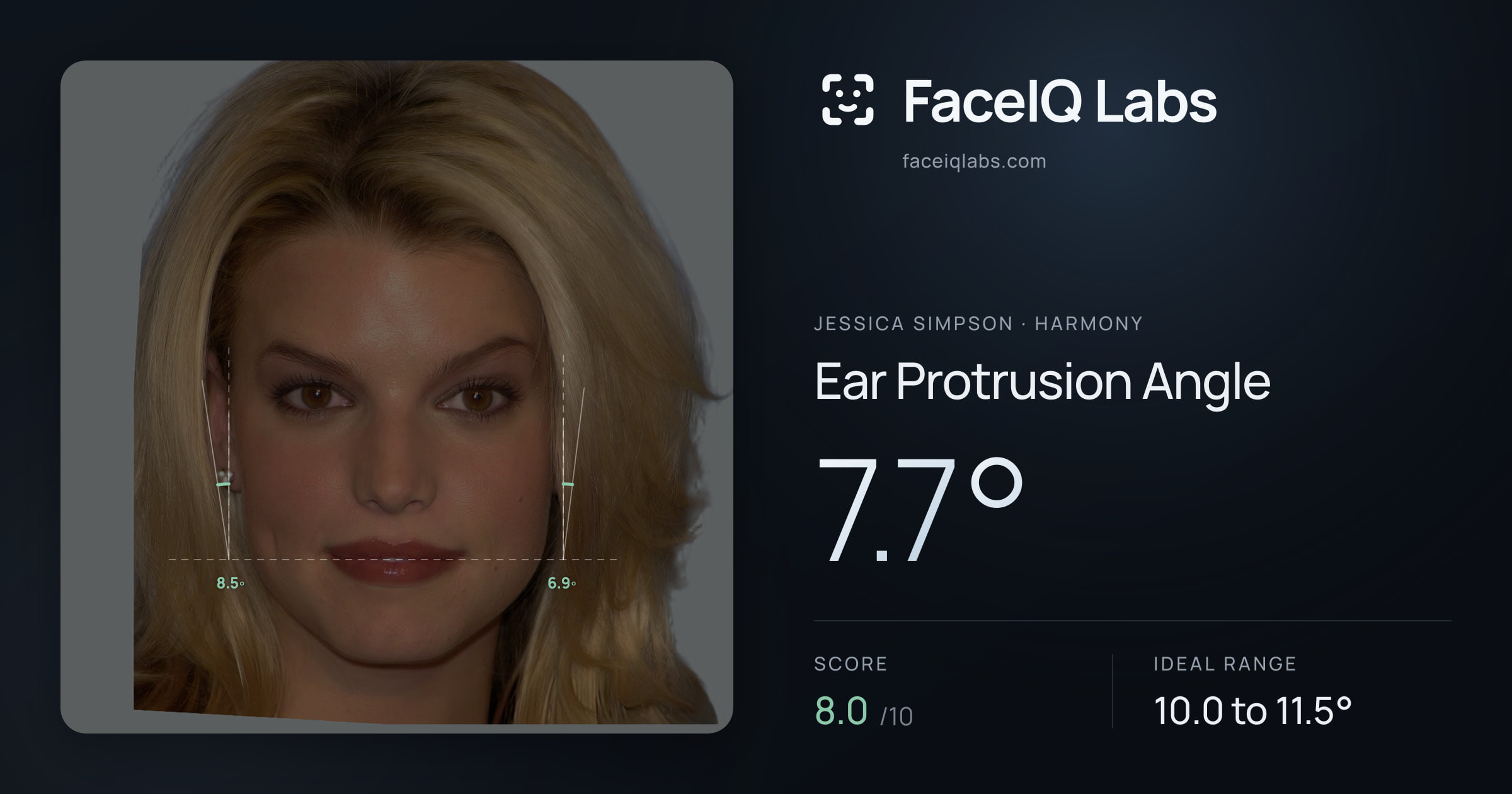 Jessica Simpson Ear Protrusion Angle: 7.7°, drawn on the photo