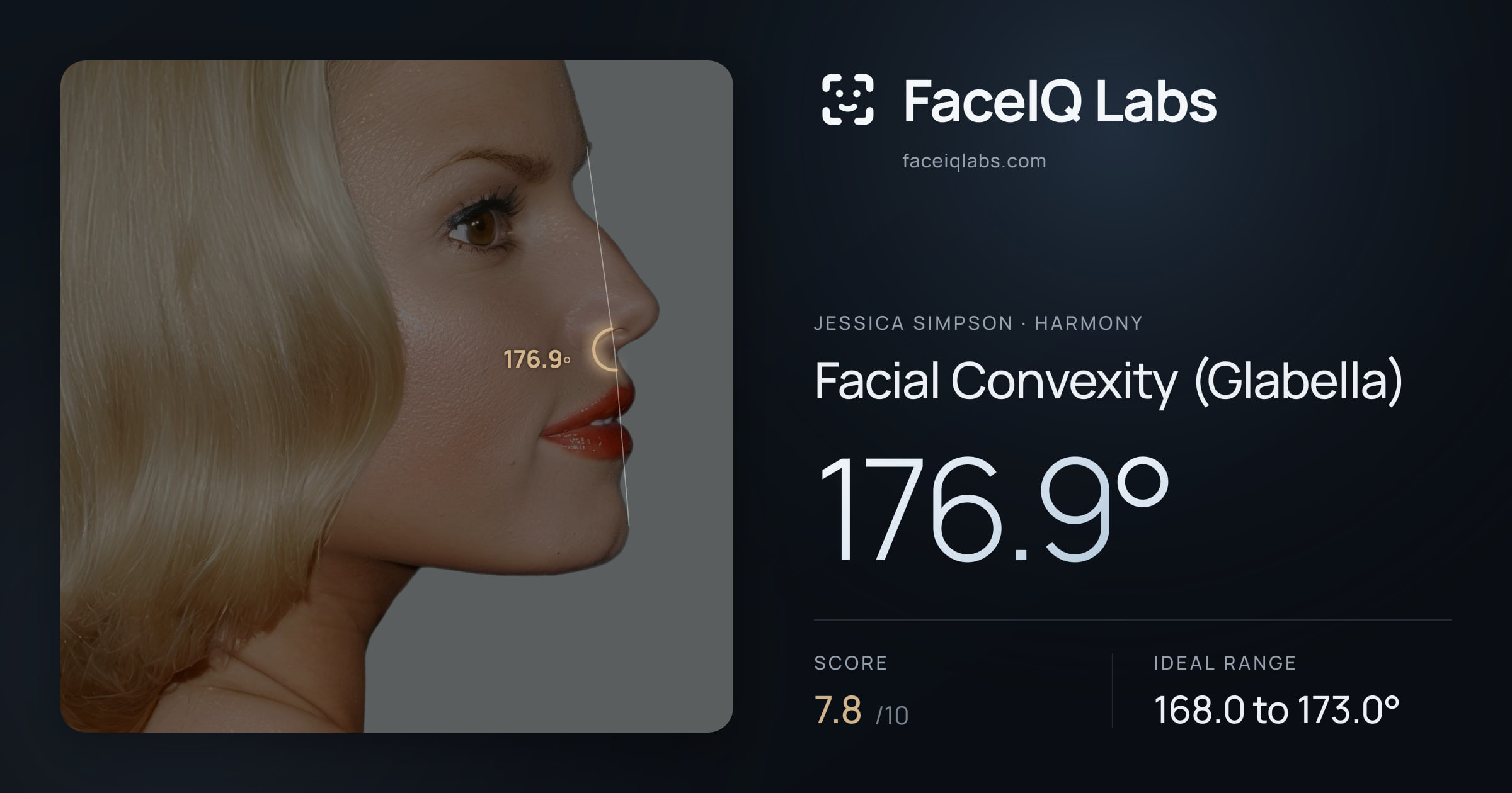 Jessica Simpson Facial Convexity (Glabella): 176.9°, drawn on the photo