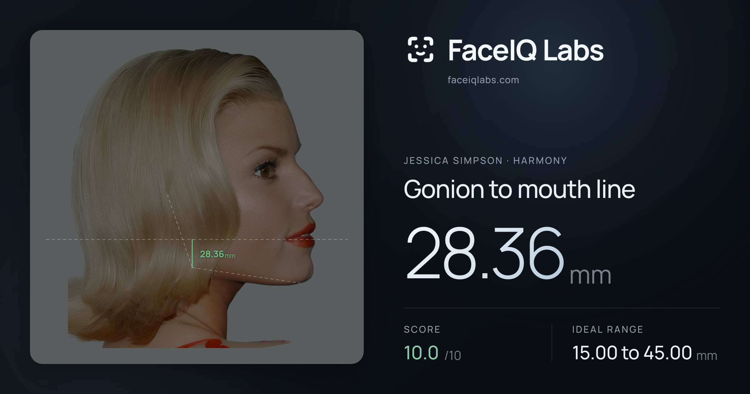 Jessica Simpson Gonion to mouth line: 28.36mm, drawn on the photo