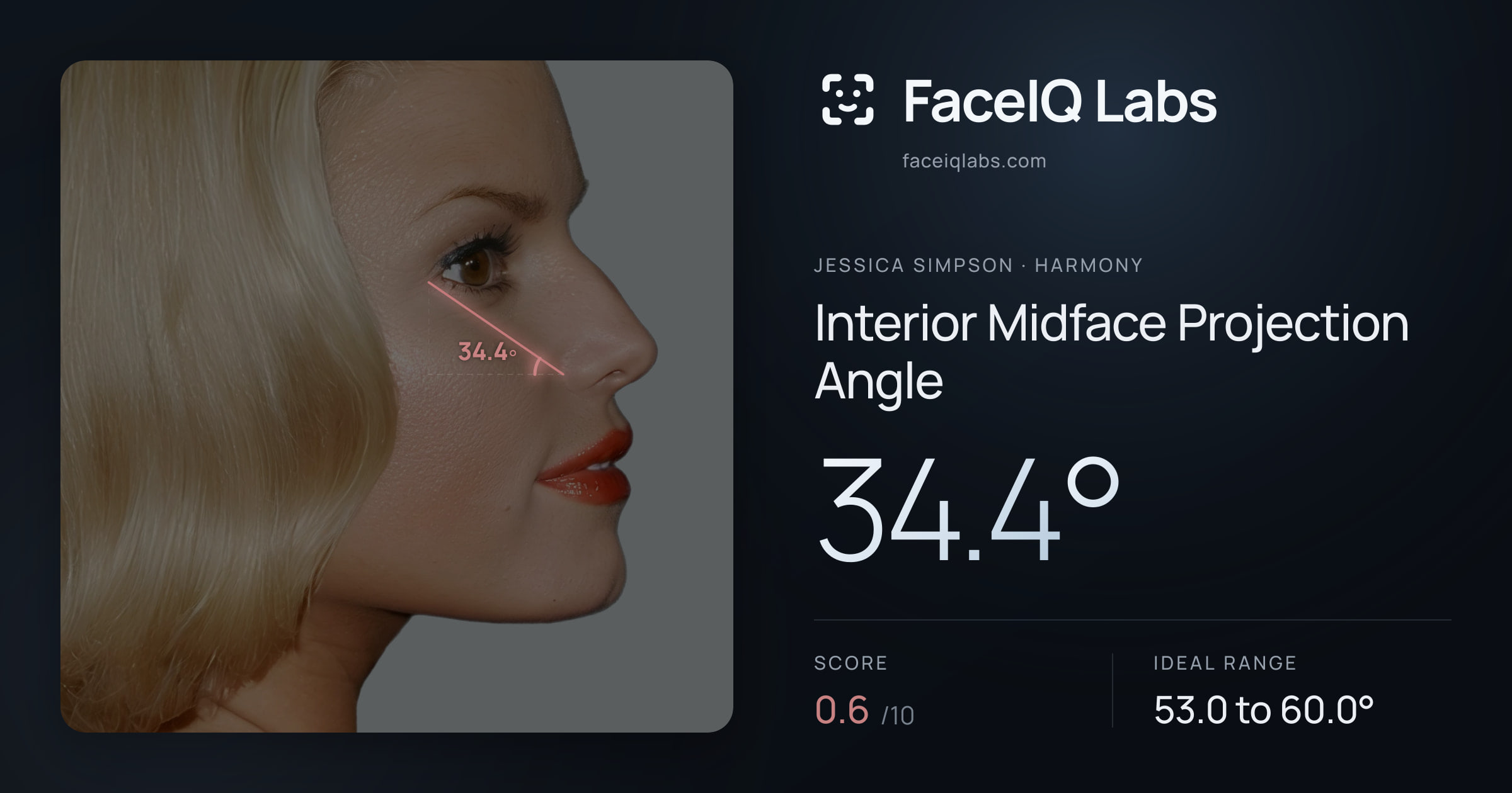 Jessica Simpson Interior Midface Projection Angle: 34.4°, drawn on the photo