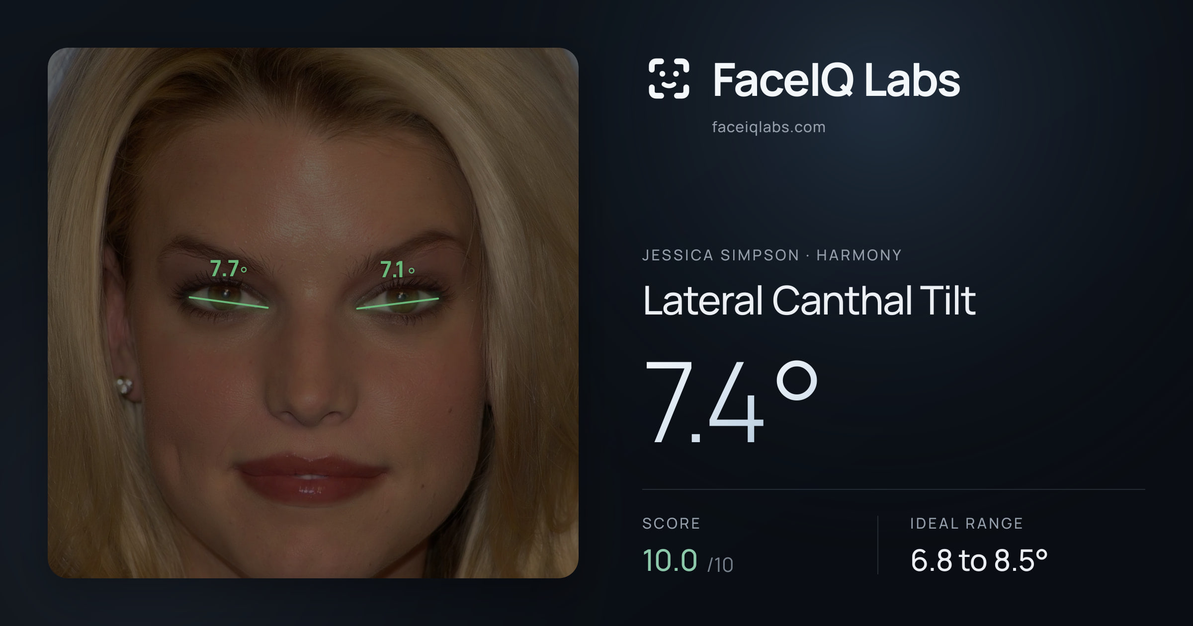 Jessica Simpson Lateral Canthal Tilt: 7.4°, drawn on the photo