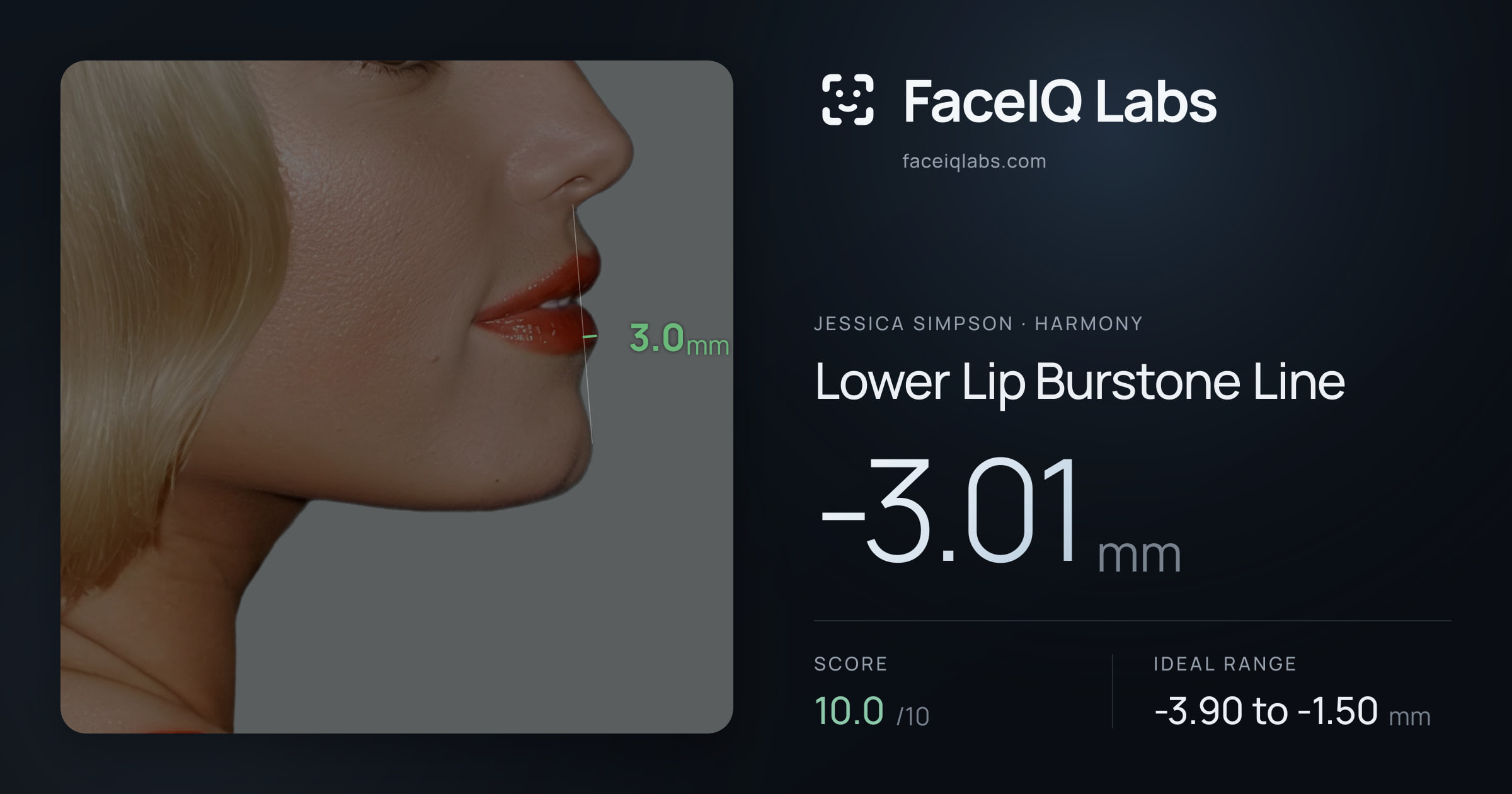 Jessica Simpson Lower Lip Burstone Line: -3.01mm, drawn on the photo