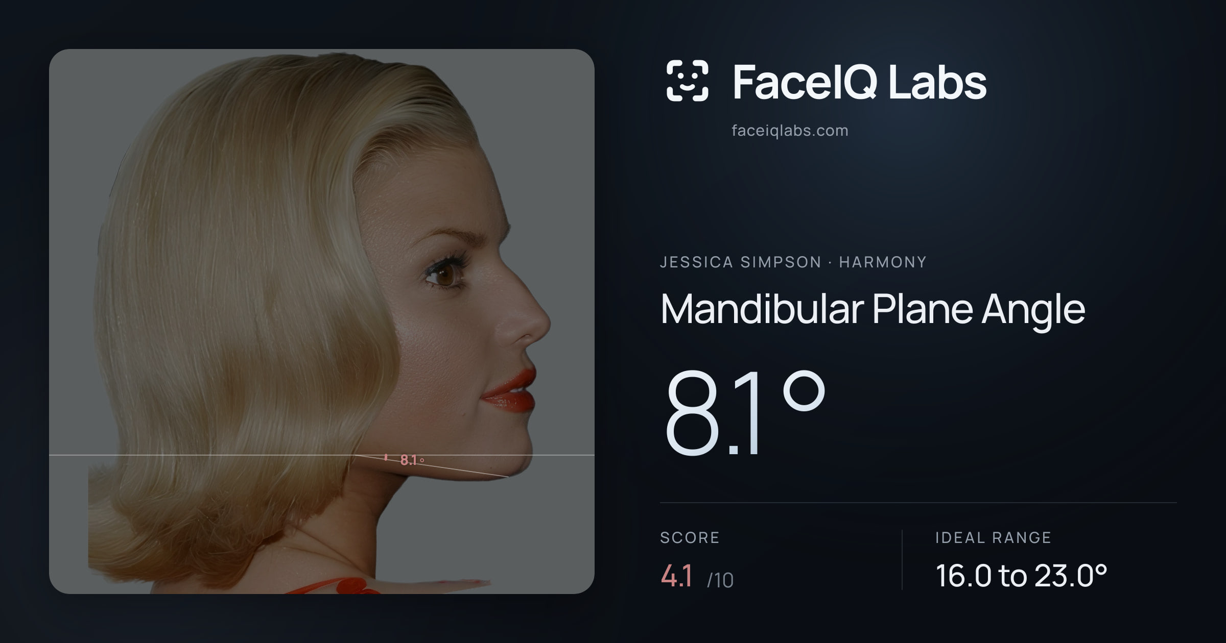 Jessica Simpson Mandibular Plane Angle: 8.1°, drawn on the photo