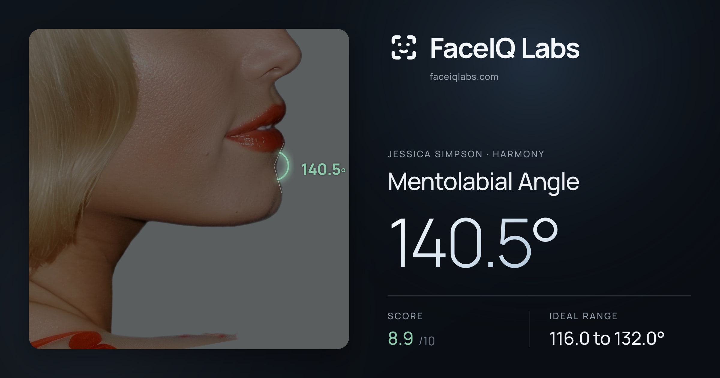 Jessica Simpson Mentolabial Angle: 140.5°, drawn on the photo