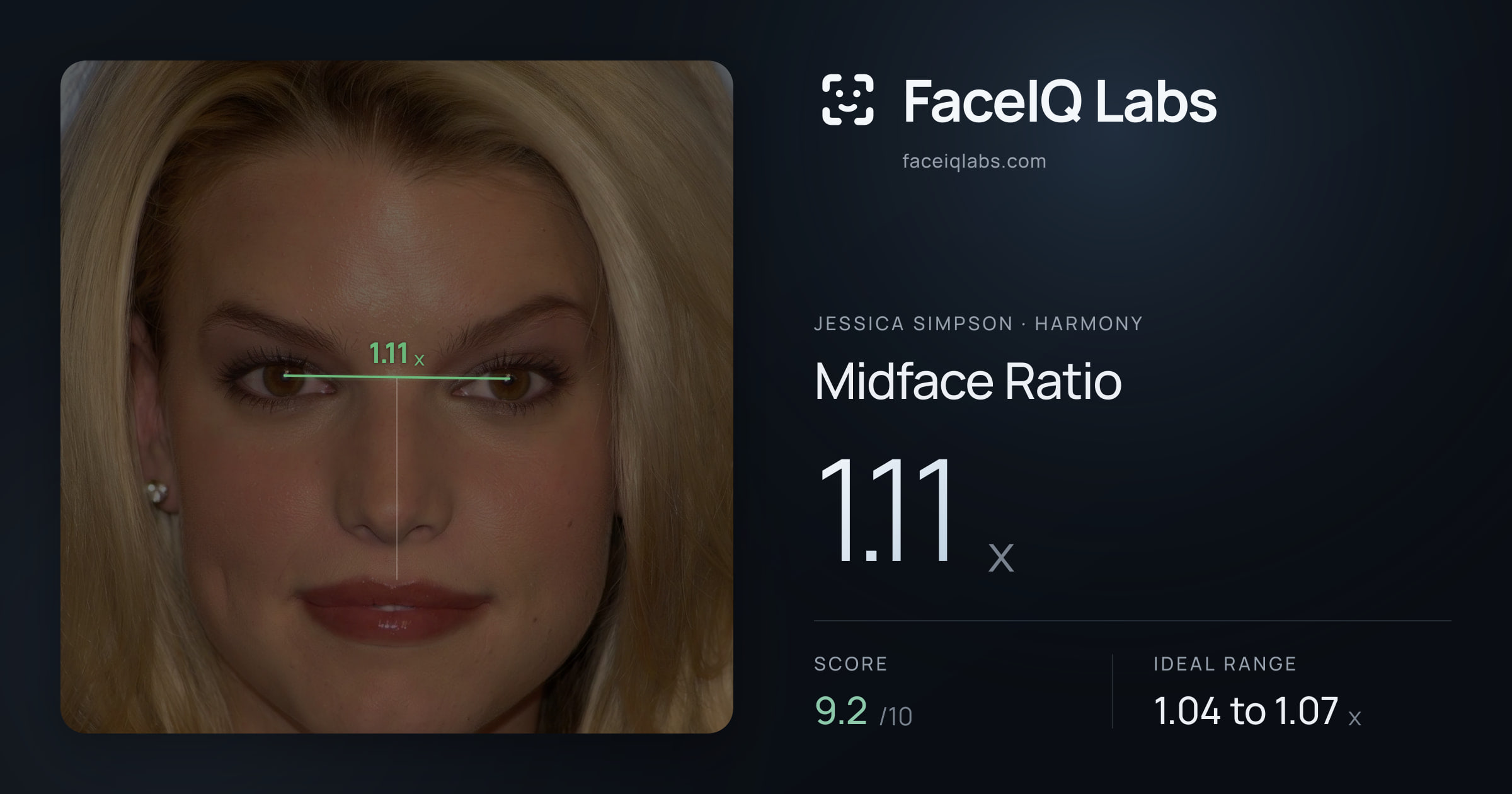Jessica Simpson Midface Ratio: 1.11x, drawn on the photo