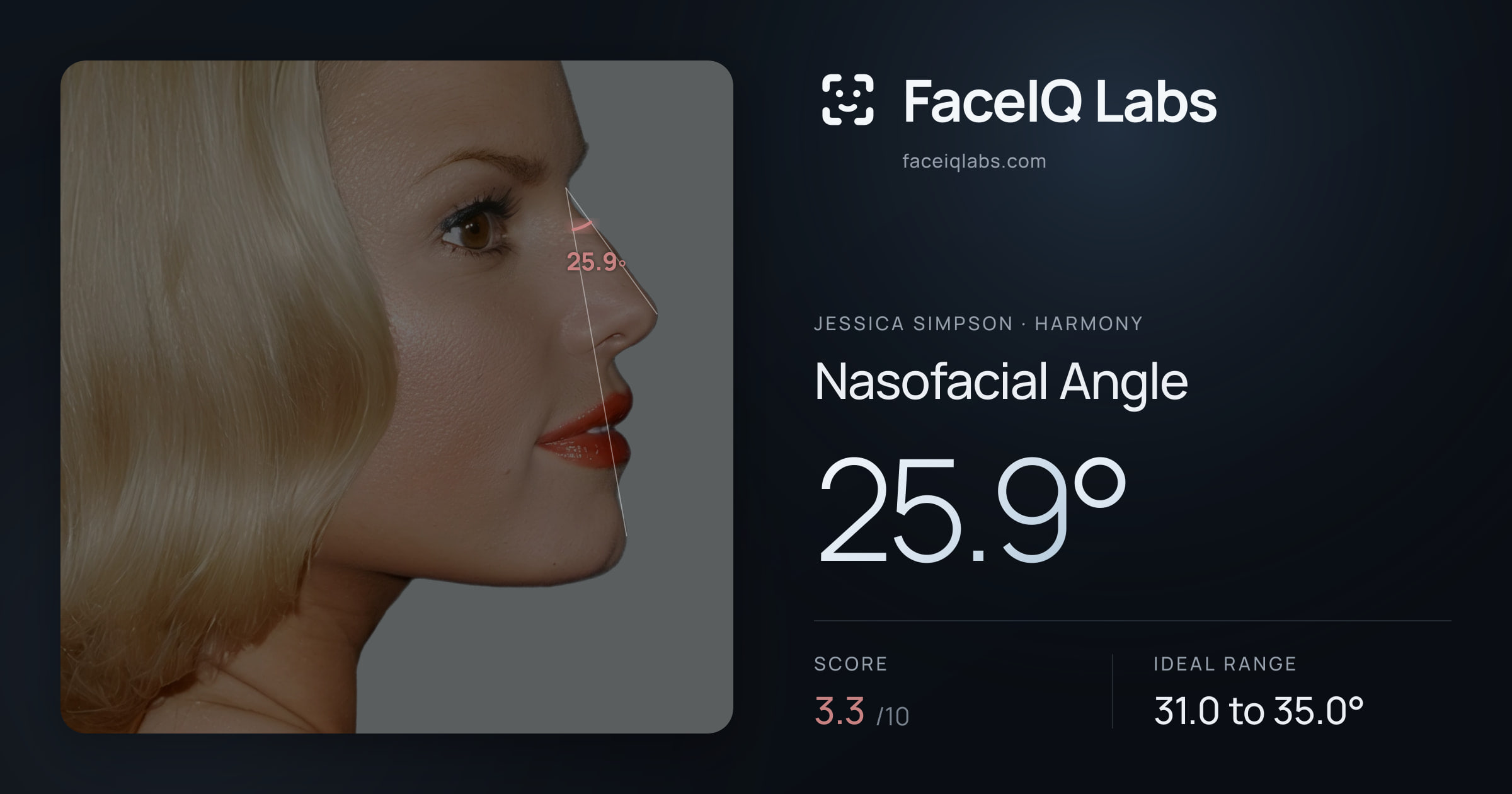 Jessica Simpson Nasofacial Angle: 25.9°, drawn on the photo