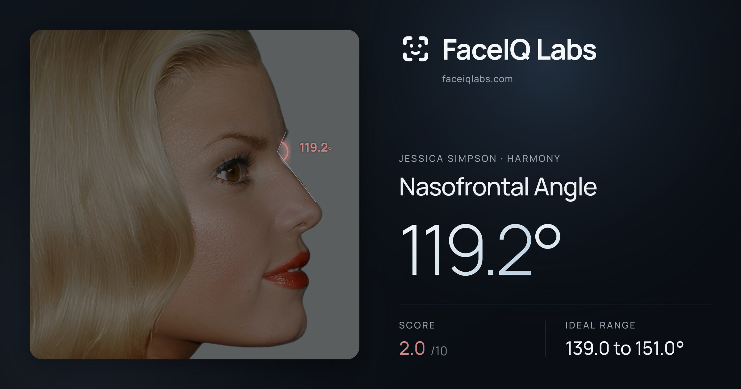 Jessica Simpson Nasofrontal Angle: 119.2°, drawn on the photo