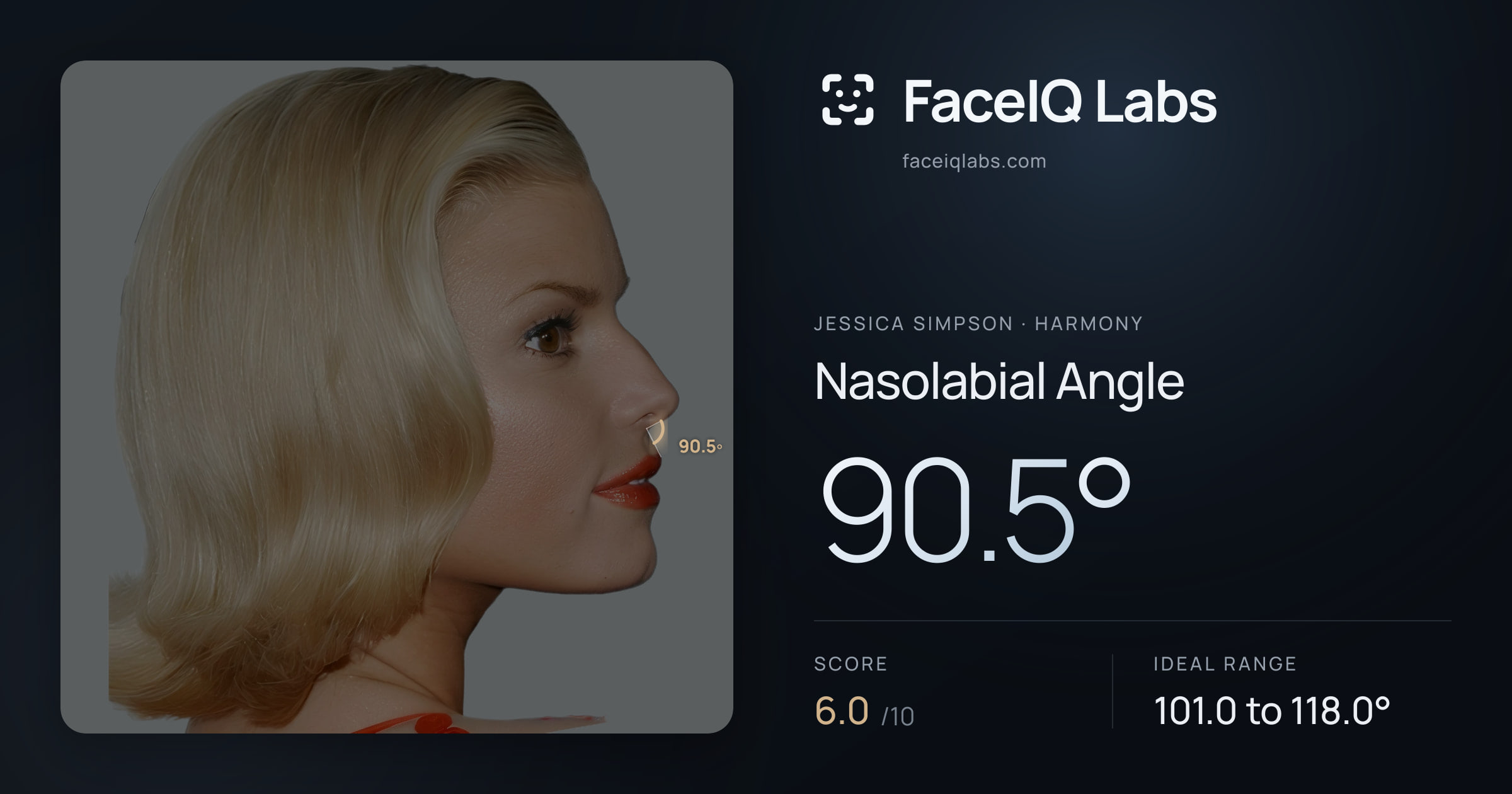 Jessica Simpson Nasolabial Angle: 90.5°, drawn on the photo