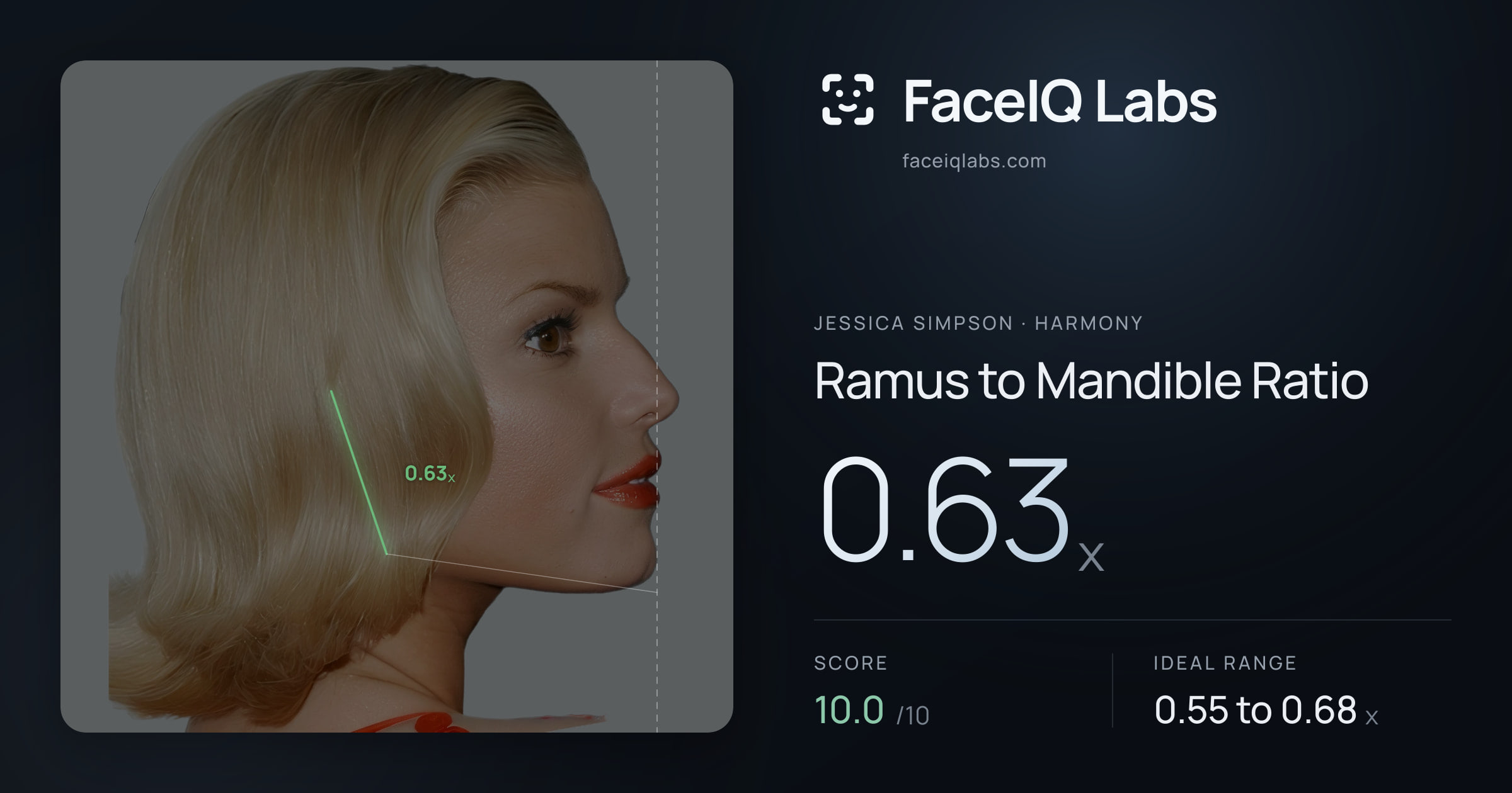 Jessica Simpson Ramus to Mandible Ratio: 0.63x, drawn on the photo