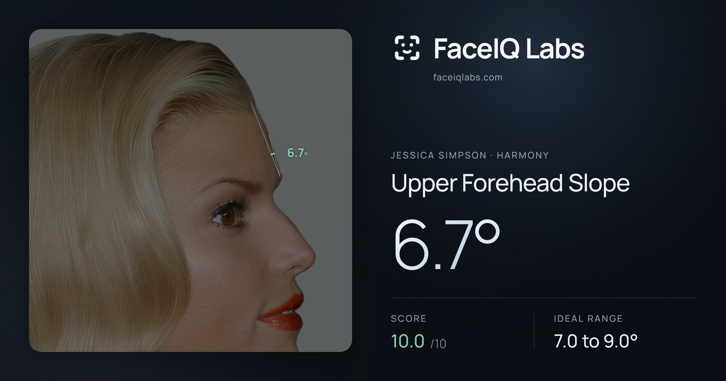 Jessica Simpson Upper Forehead Slope: 6.7°, drawn on the photo