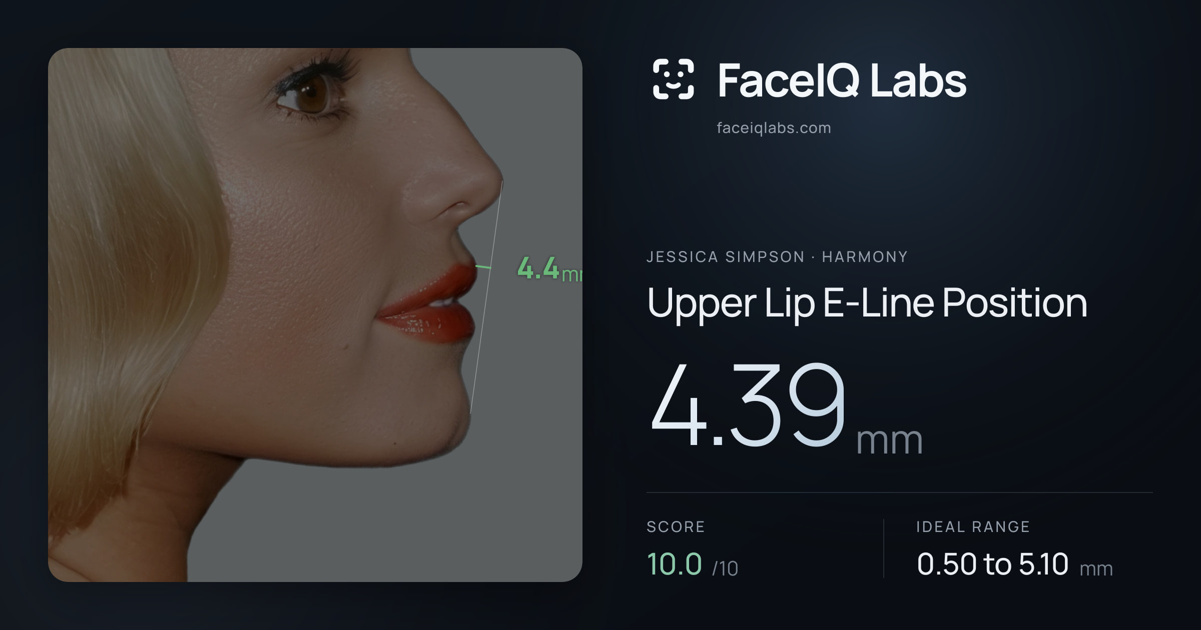Jessica Simpson Upper Lip E-Line Position: 4.39mm, drawn on the photo