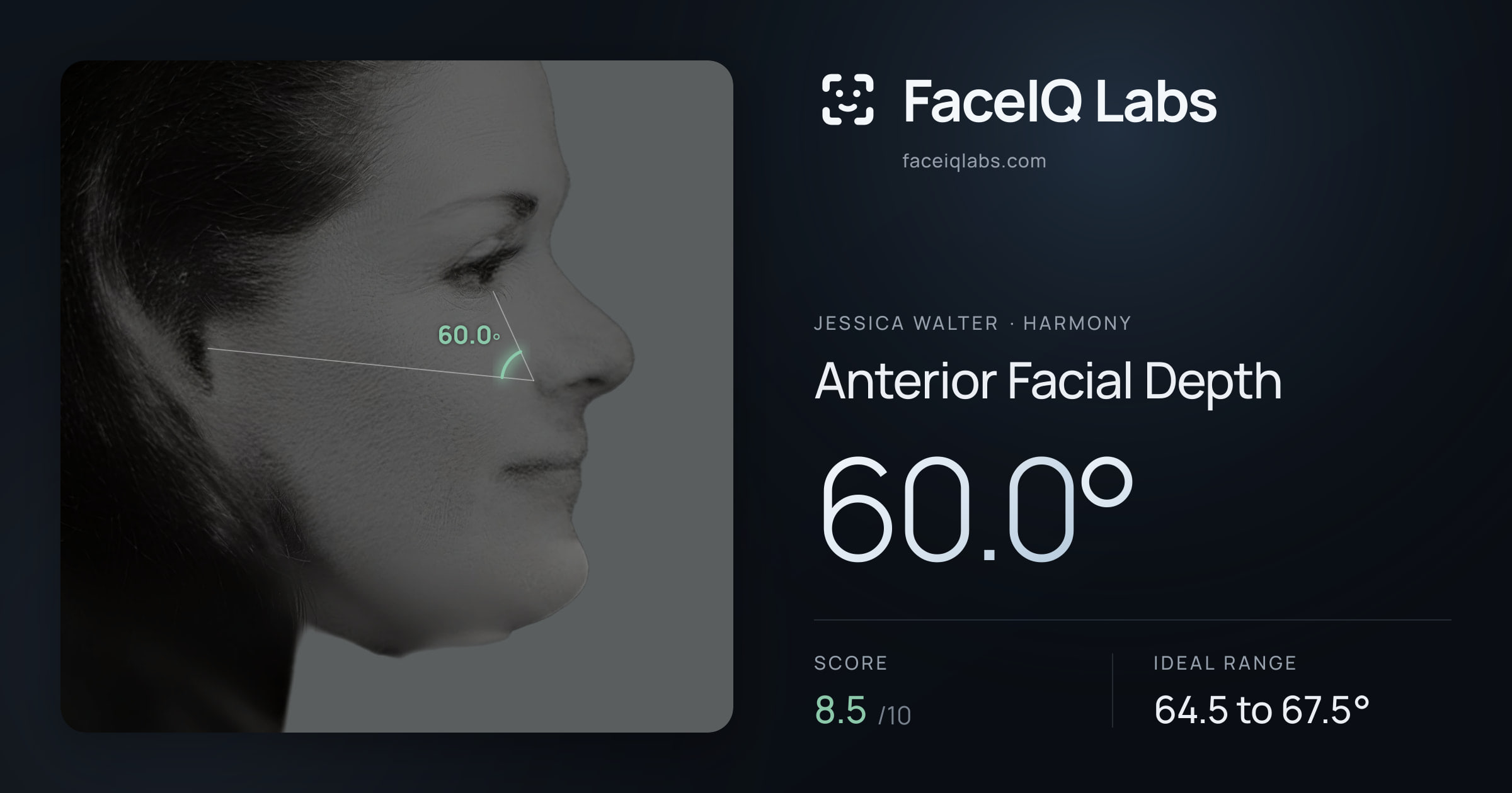 Jessica Walter Anterior Facial Depth: 60.0°, drawn on the photo