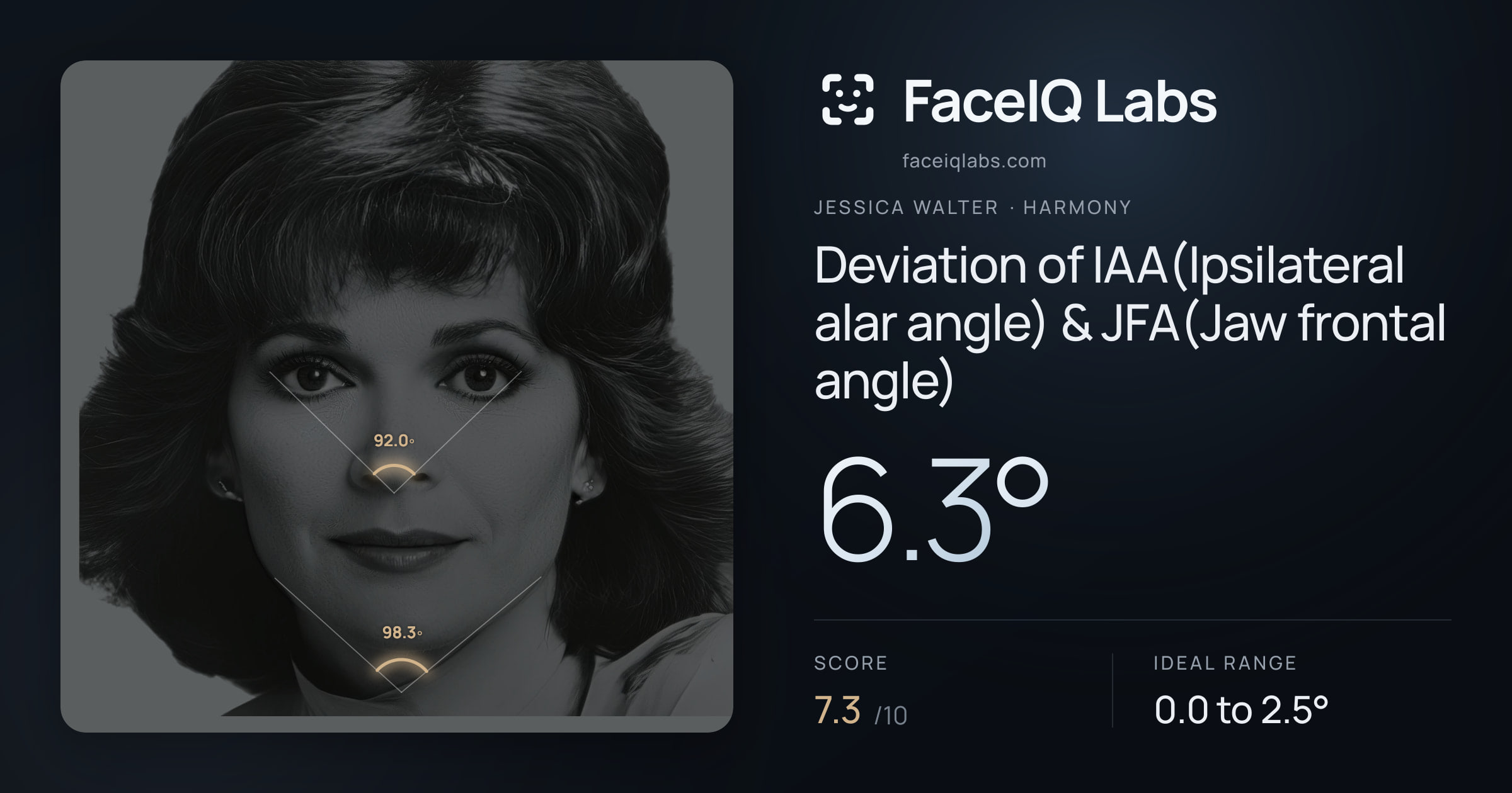 Jessica Walter Deviation of IAA(Ipsilateral alar angle) & JFA(Jaw frontal angle): 6.3°, drawn on the photo