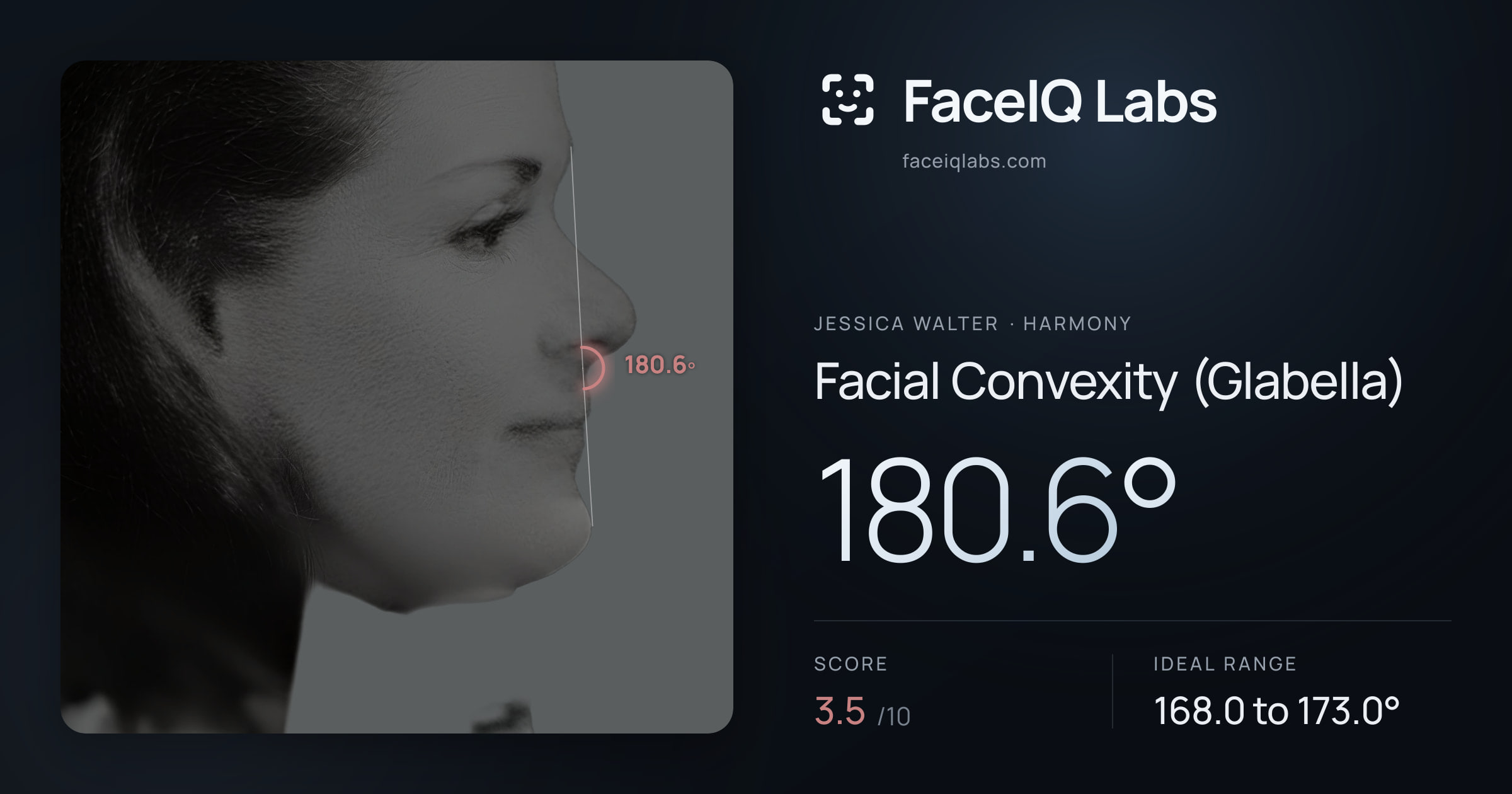 Jessica Walter Facial Convexity (Glabella): 180.6°, drawn on the photo