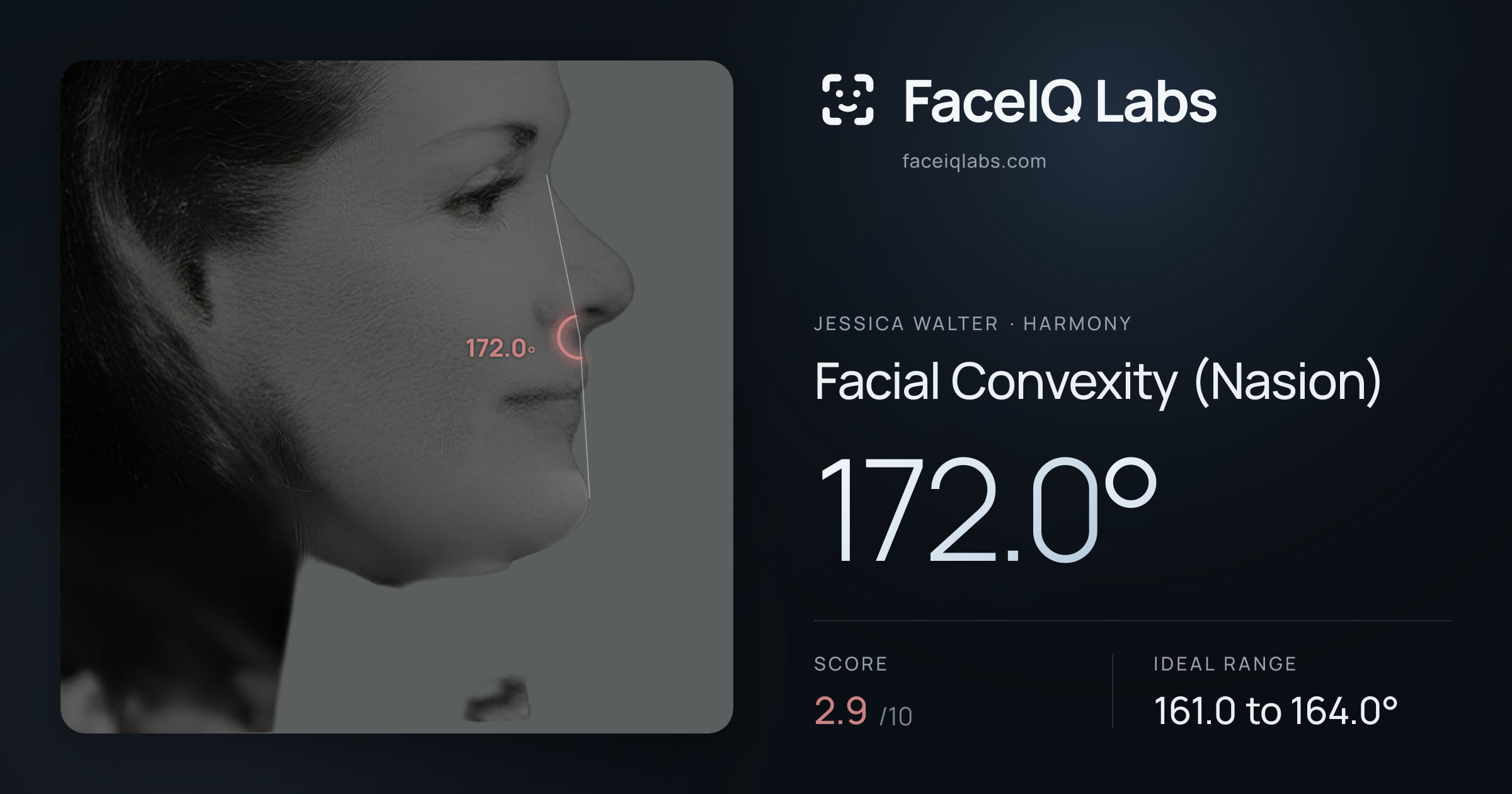Jessica Walter Facial Convexity (Nasion): 172.0°, drawn on the photo