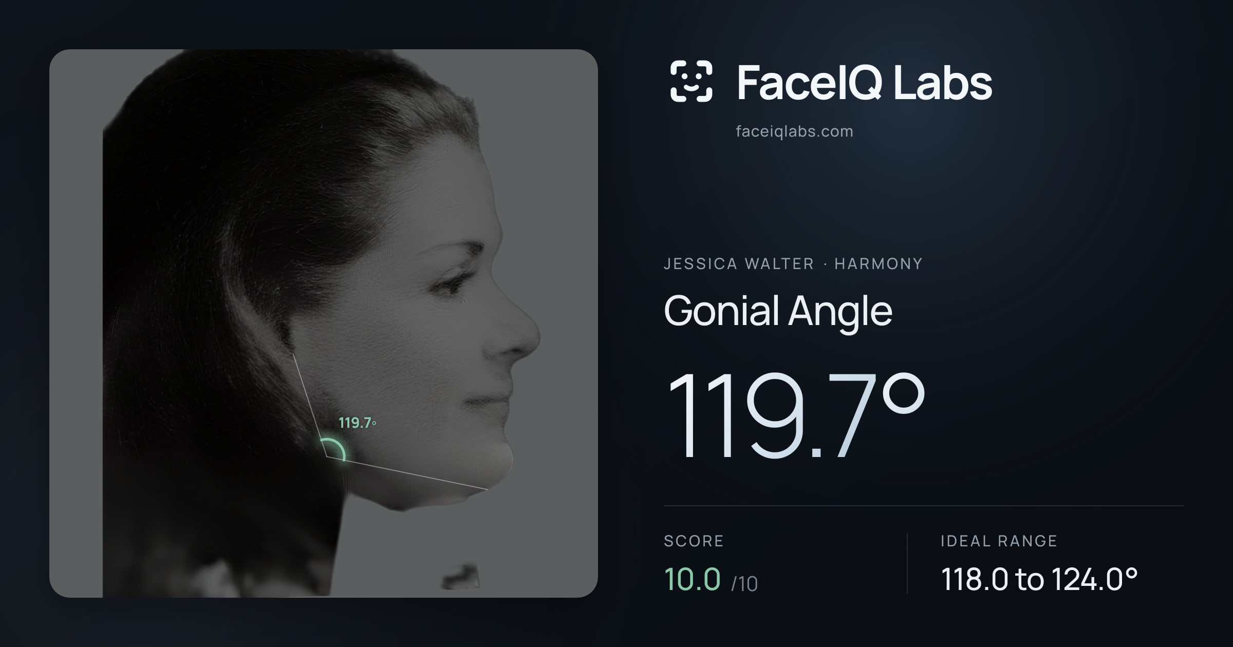 Jessica Walter Gonial Angle: 119.7°, drawn on the photo