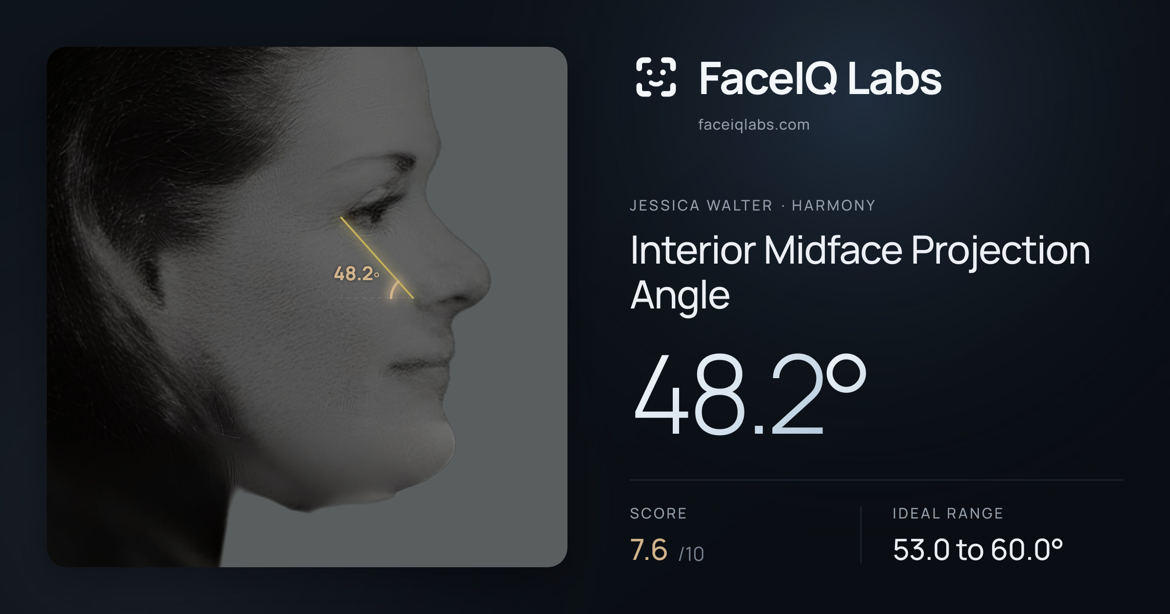 Jessica Walter Interior Midface Projection Angle: 48.2°, drawn on the photo