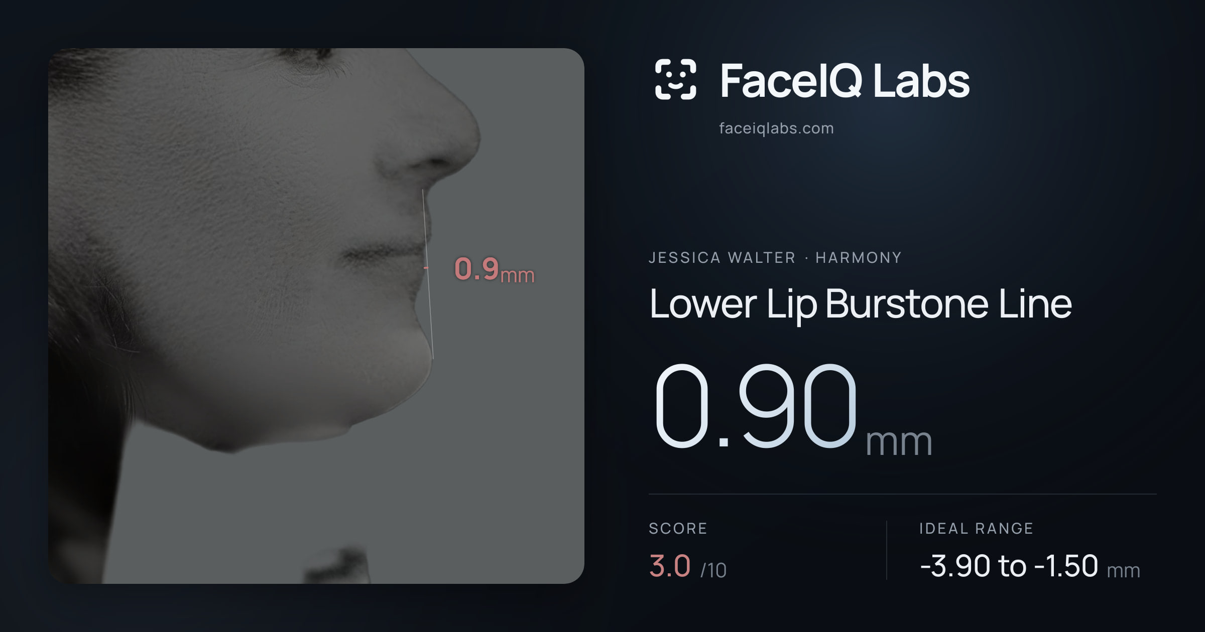 Jessica Walter Lower Lip Burstone Line: 0.90mm, drawn on the photo