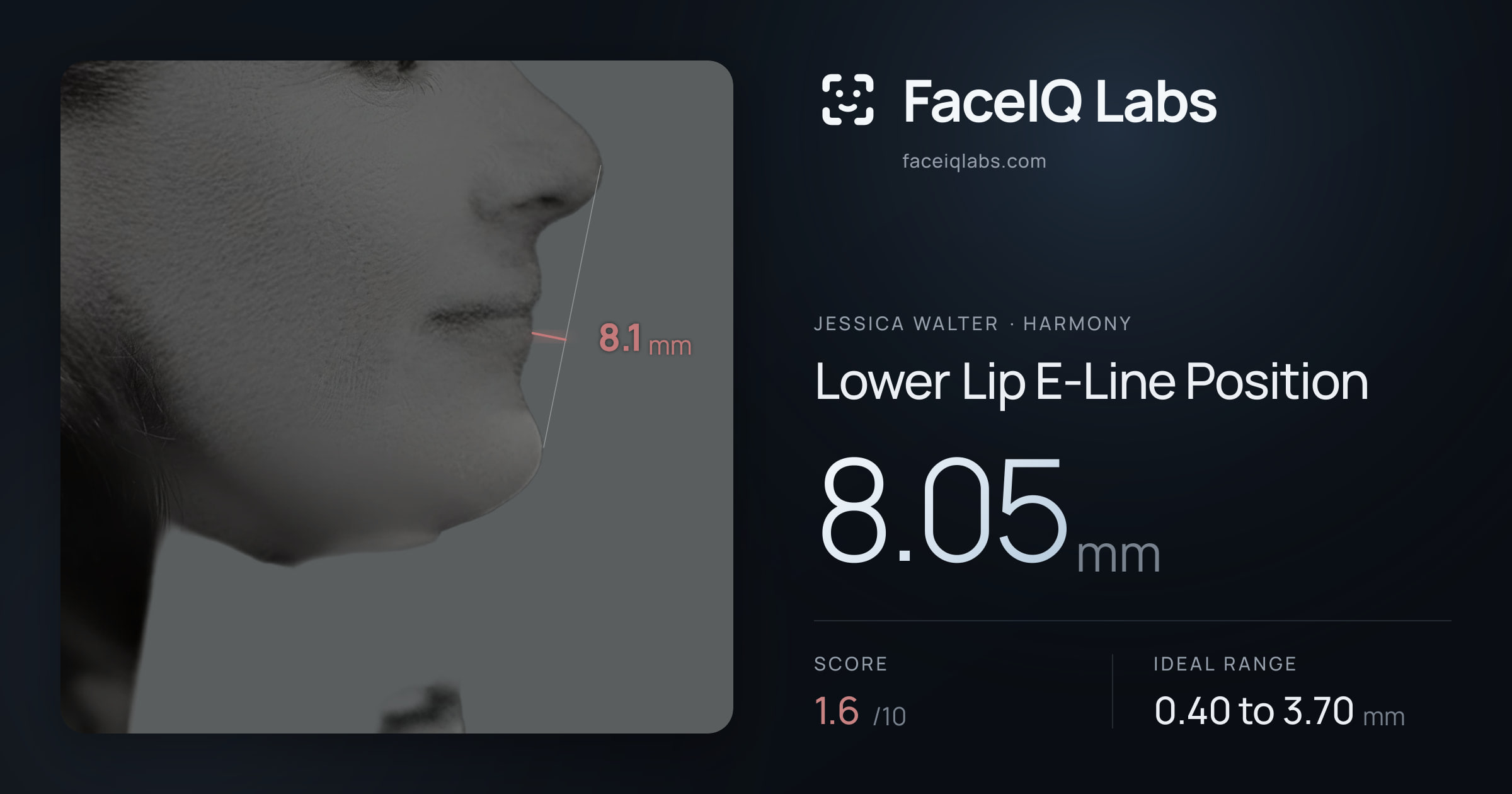 Jessica Walter Lower Lip E-Line Position: 8.05mm, drawn on the photo