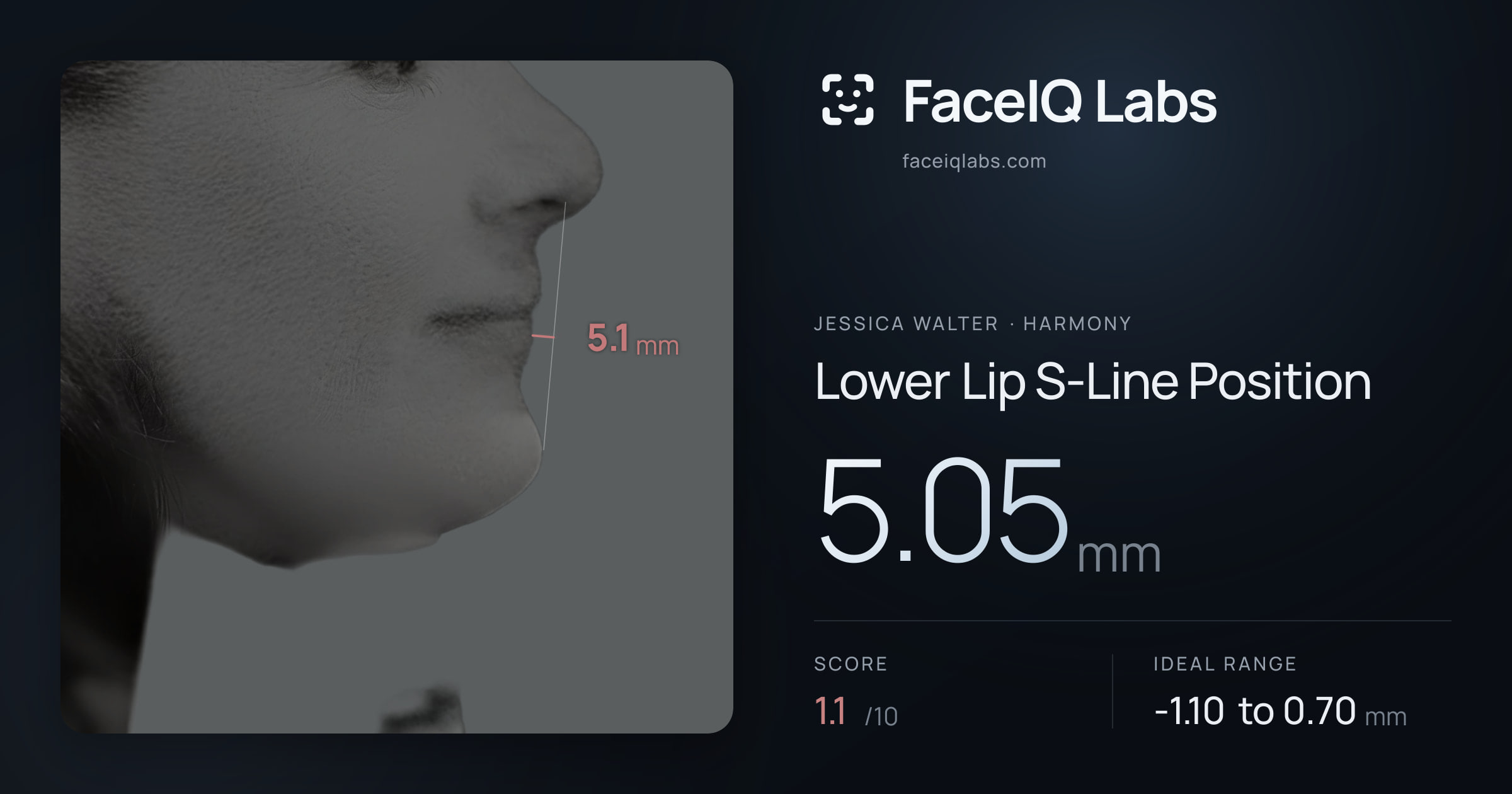 Jessica Walter Lower Lip S-Line Position: 5.05mm, drawn on the photo