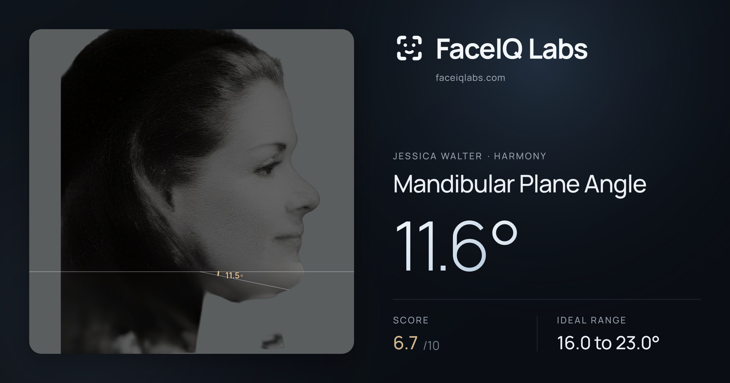 Jessica Walter Mandibular Plane Angle: 11.6°, drawn on the photo