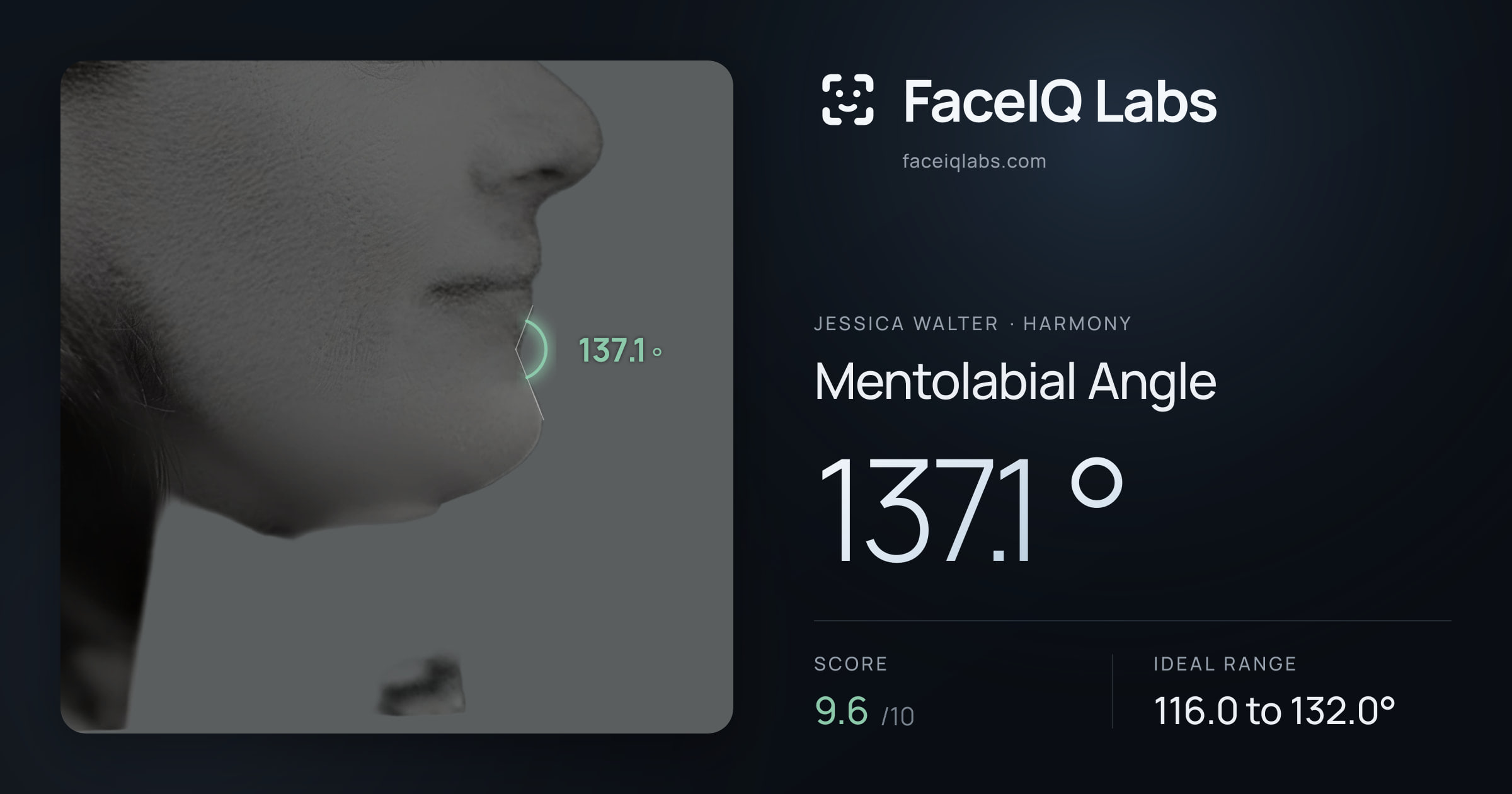 Jessica Walter Mentolabial Angle: 137.1°, drawn on the photo