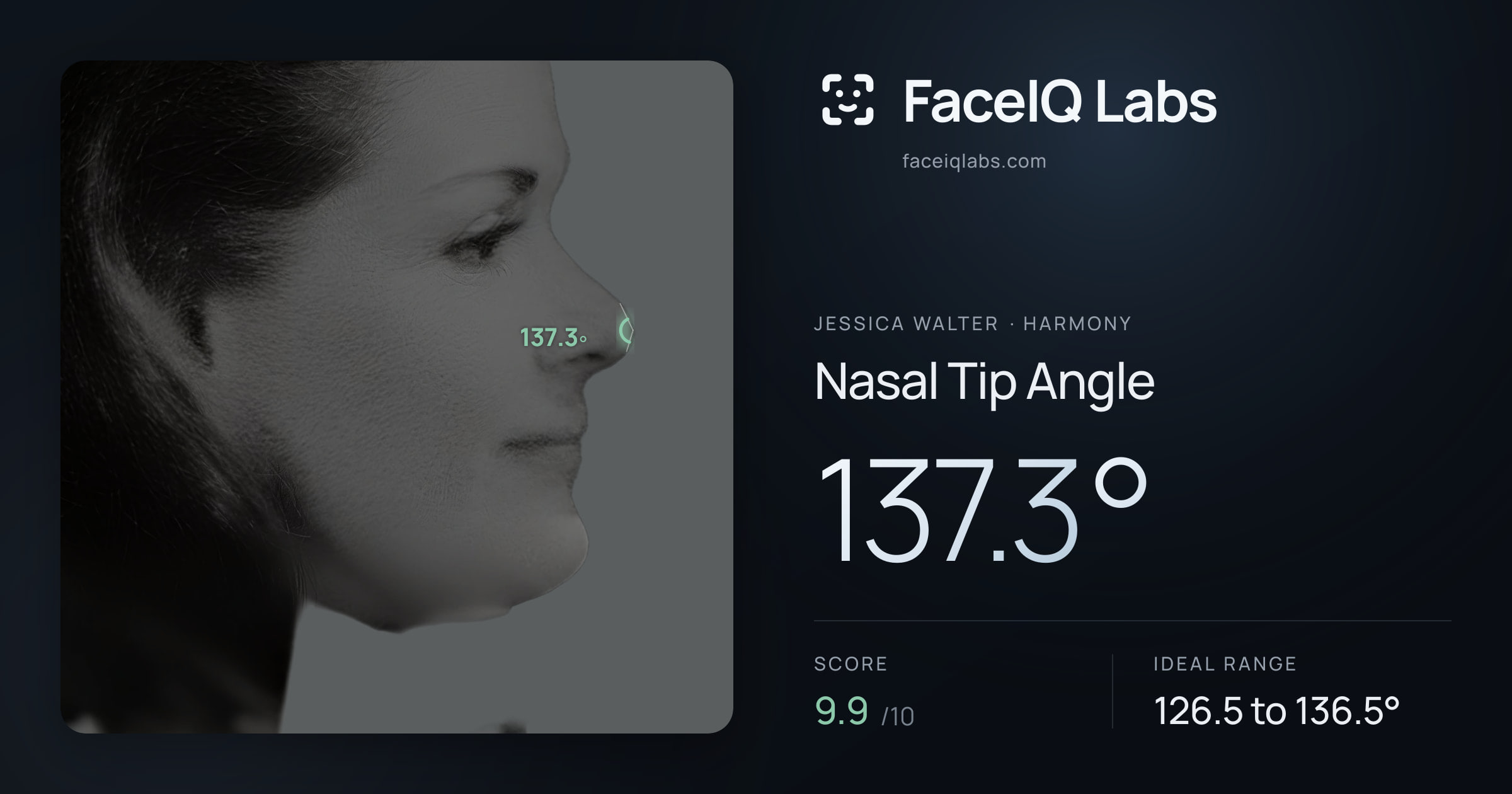 Jessica Walter Nasal Tip Angle: 137.3°, drawn on the photo