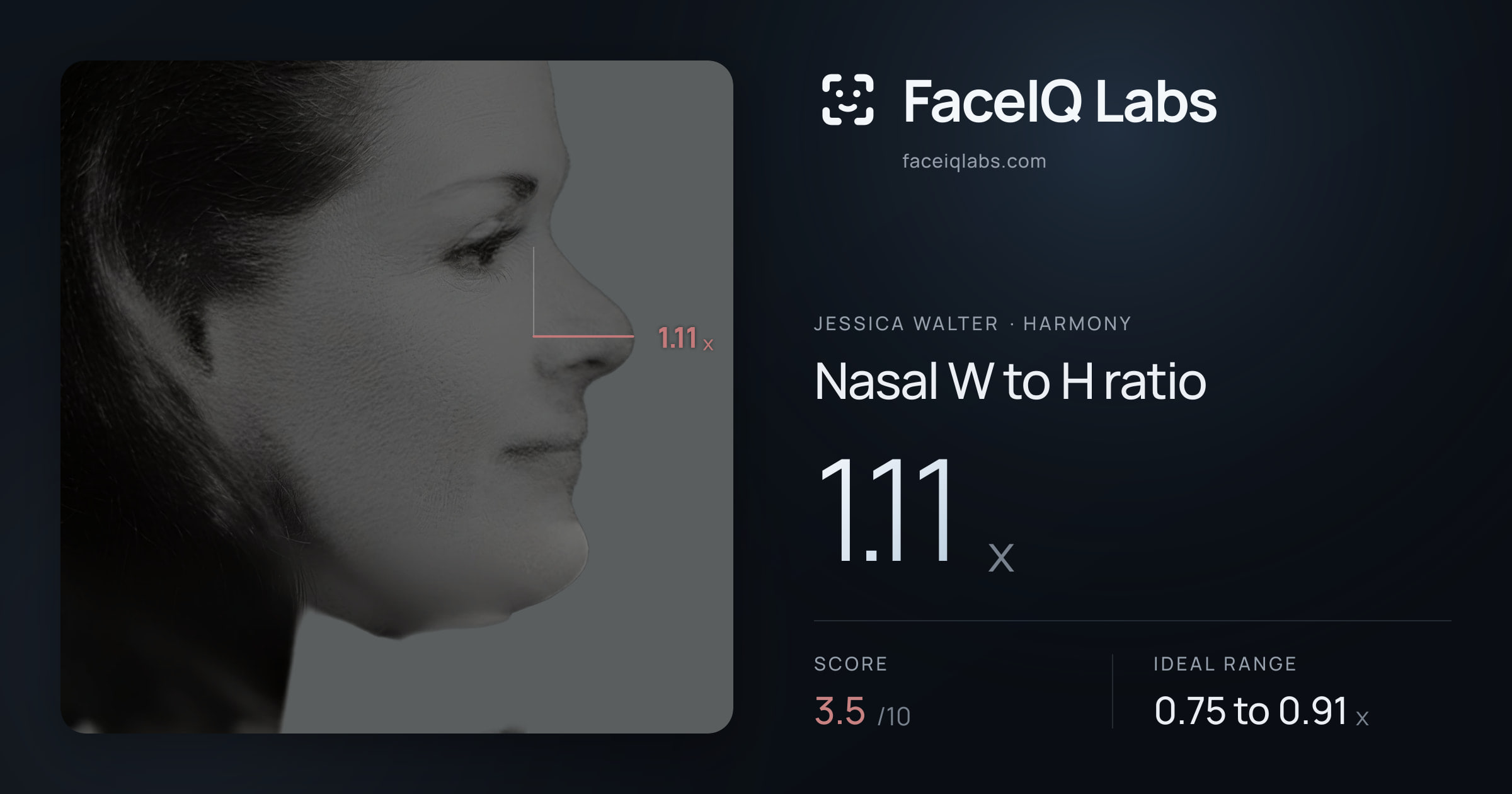 Jessica Walter Nasal W to H ratio: 1.11x, drawn on the photo