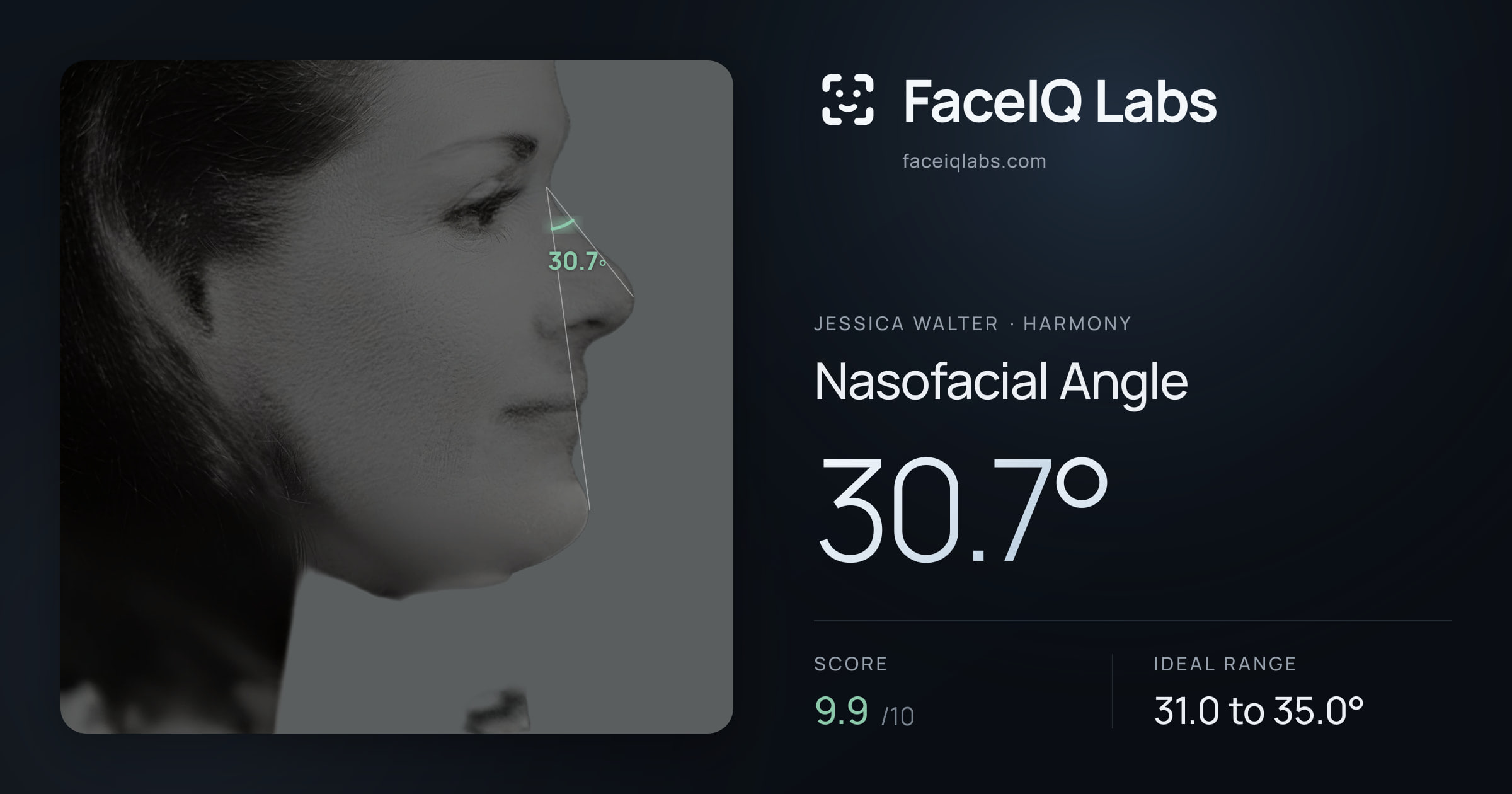 Jessica Walter Nasofacial Angle: 30.7°, drawn on the photo