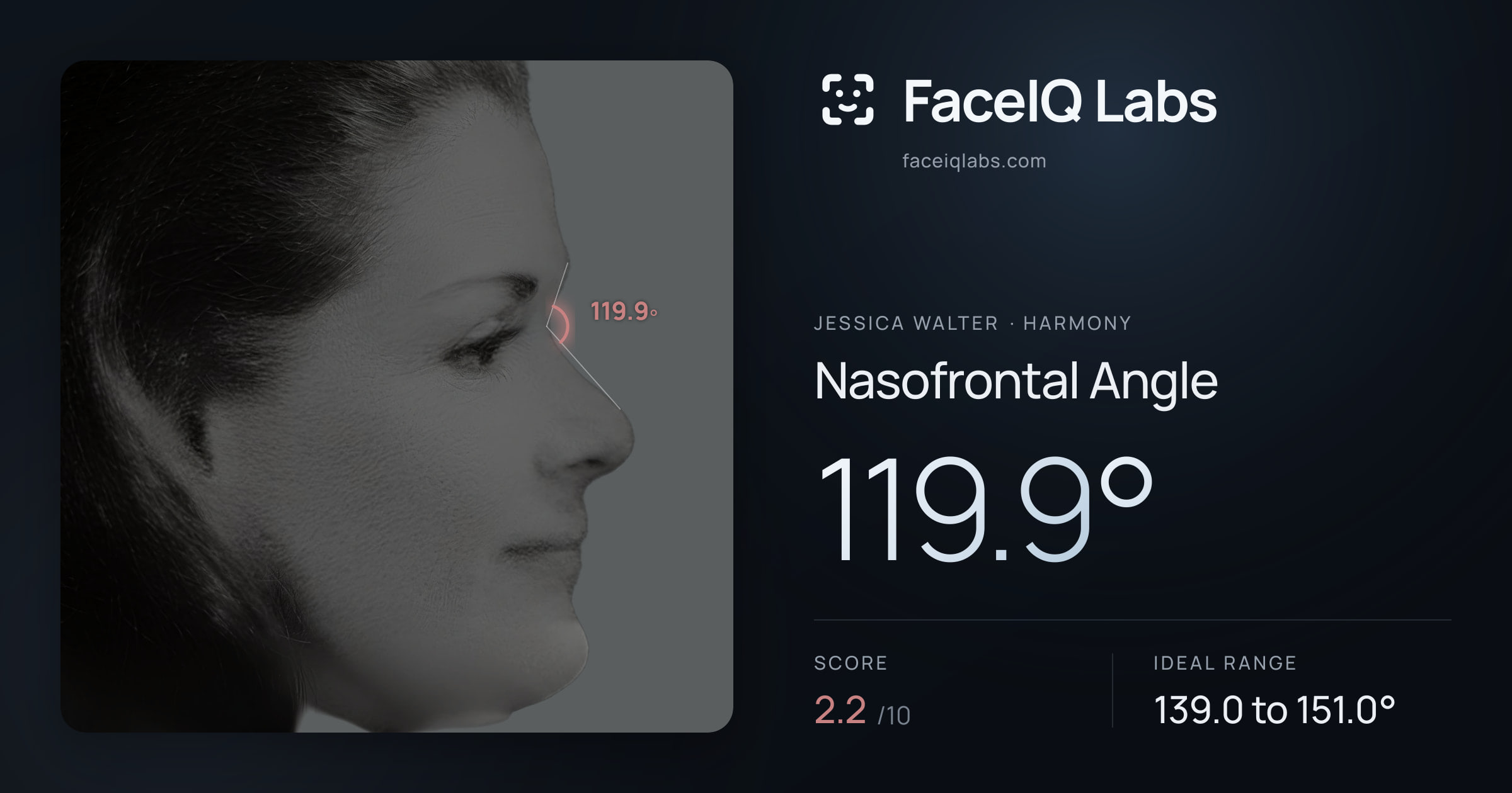 Jessica Walter Nasofrontal Angle: 119.9°, drawn on the photo