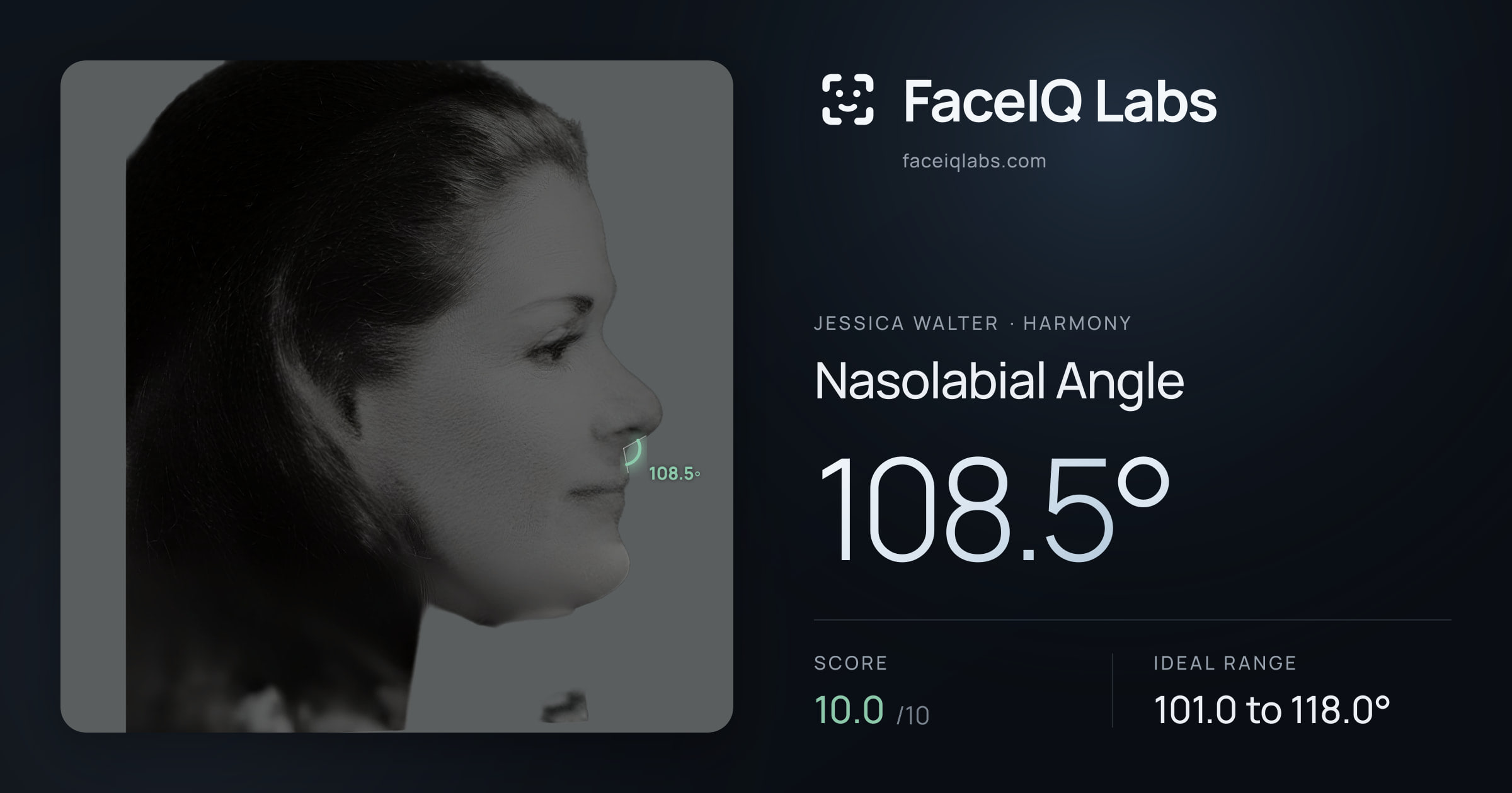 Jessica Walter Nasolabial Angle: 108.5°, drawn on the photo