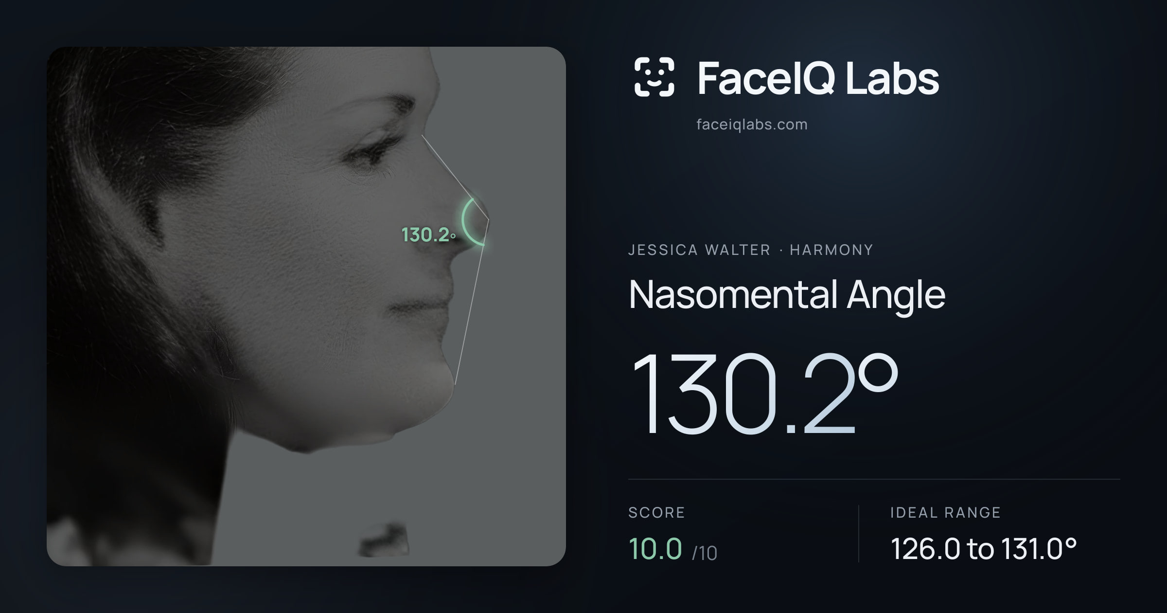 Jessica Walter Nasomental Angle: 130.2°, drawn on the photo