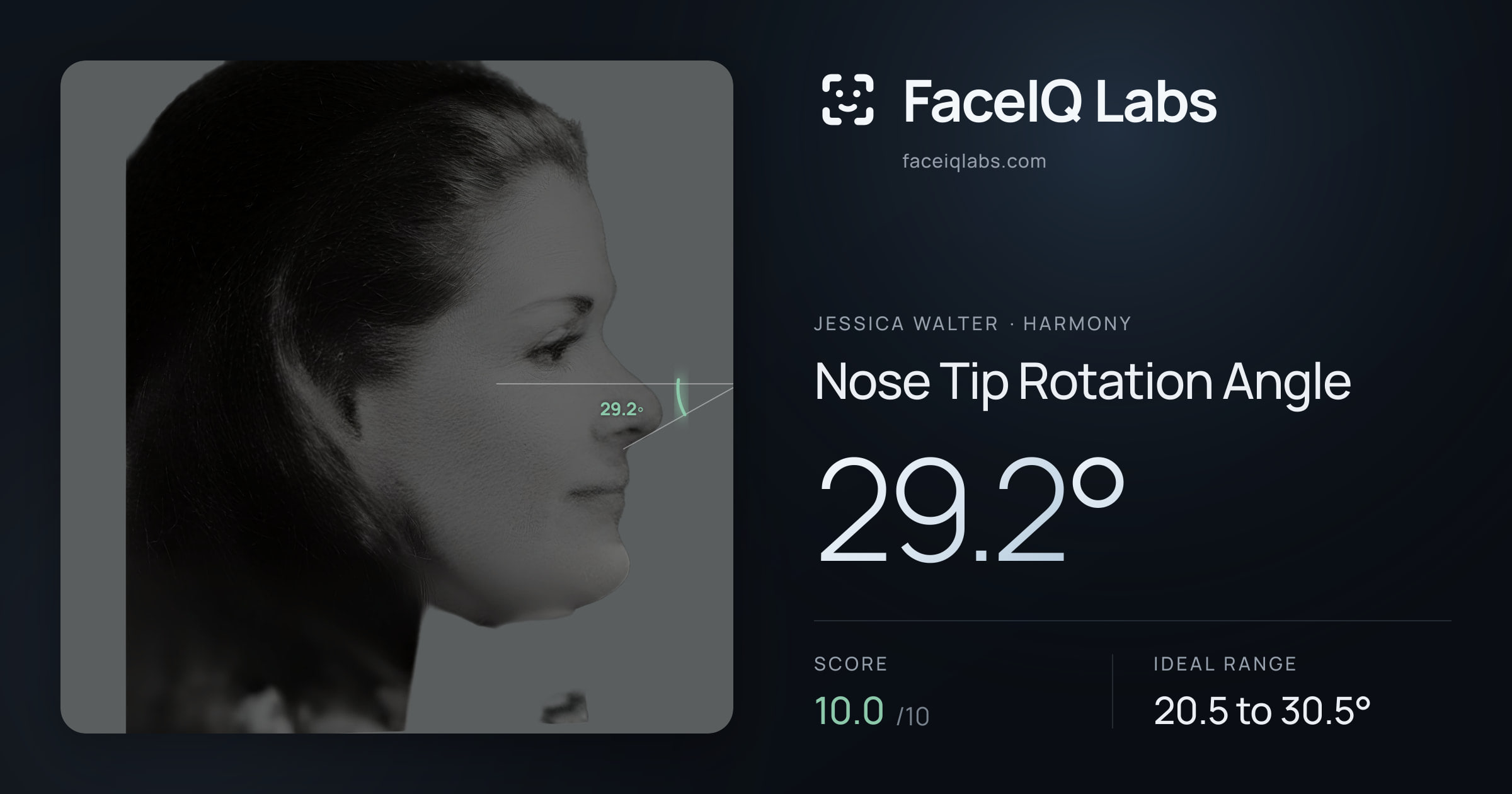 Jessica Walter Nose Tip Rotation Angle: 29.2°, drawn on the photo