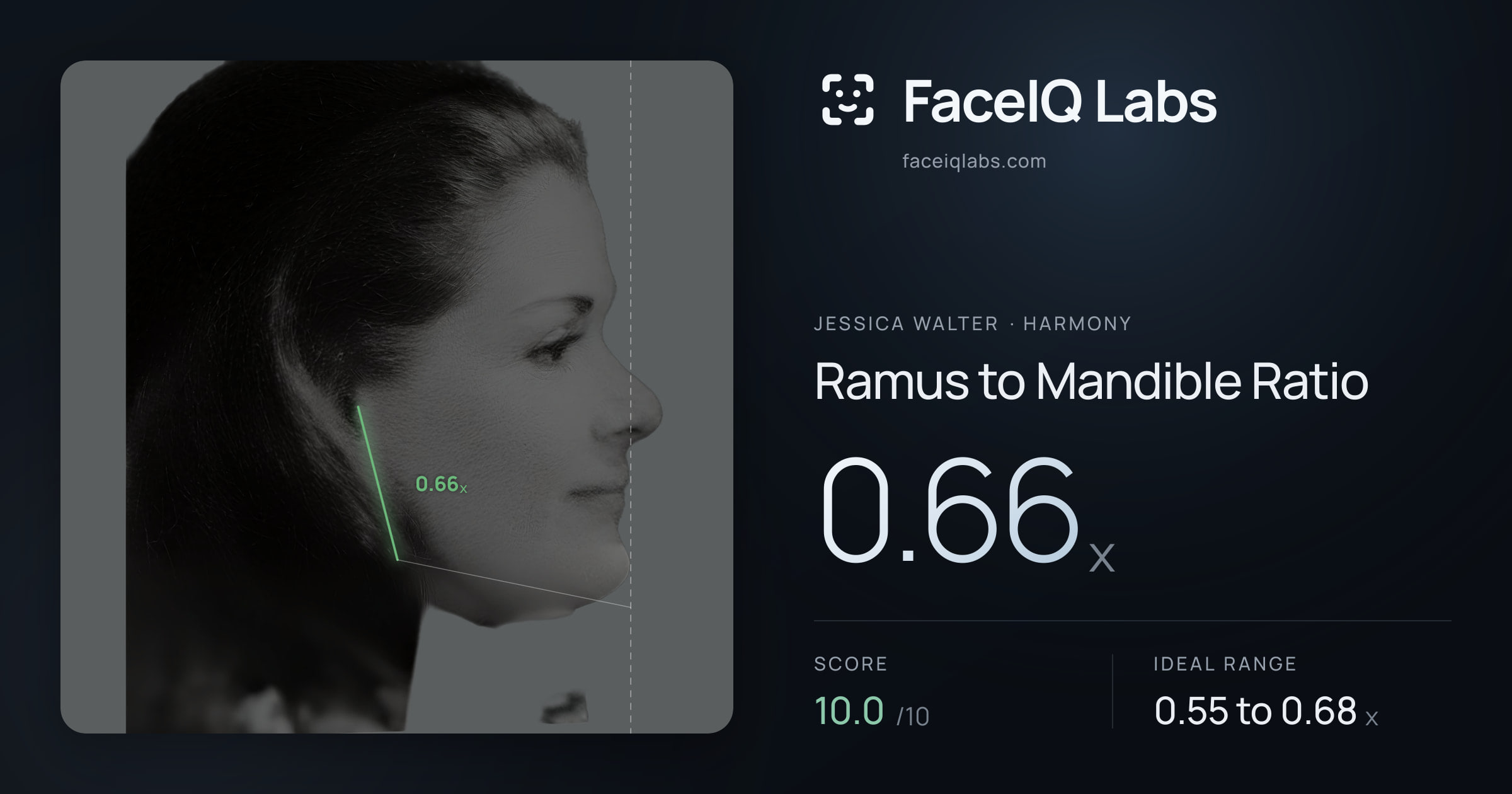 Jessica Walter Ramus to Mandible Ratio: 0.66x, drawn on the photo