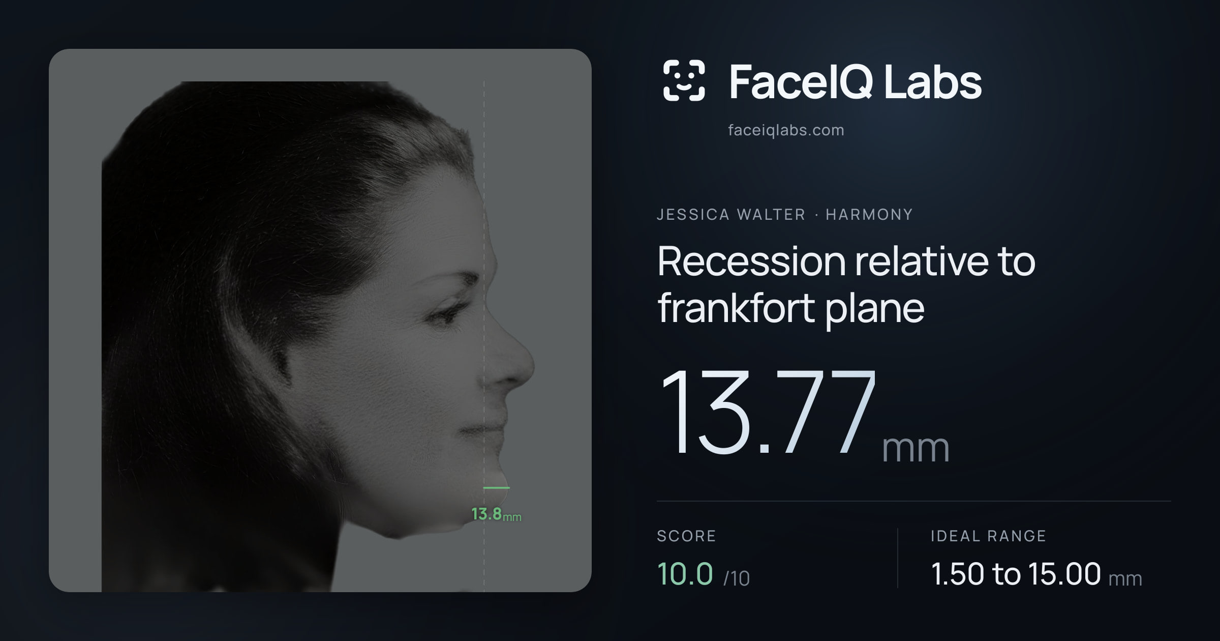 Jessica Walter Recession relative to frankfort plane: 13.77mm, drawn on the photo