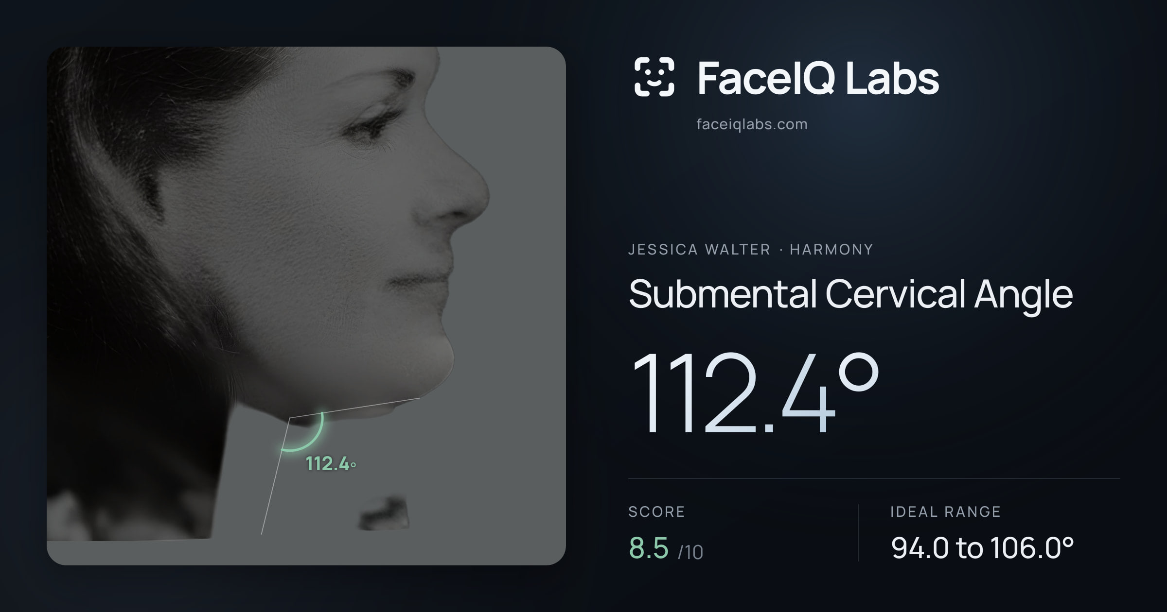 Jessica Walter Submental Cervical Angle: 112.4°, drawn on the photo
