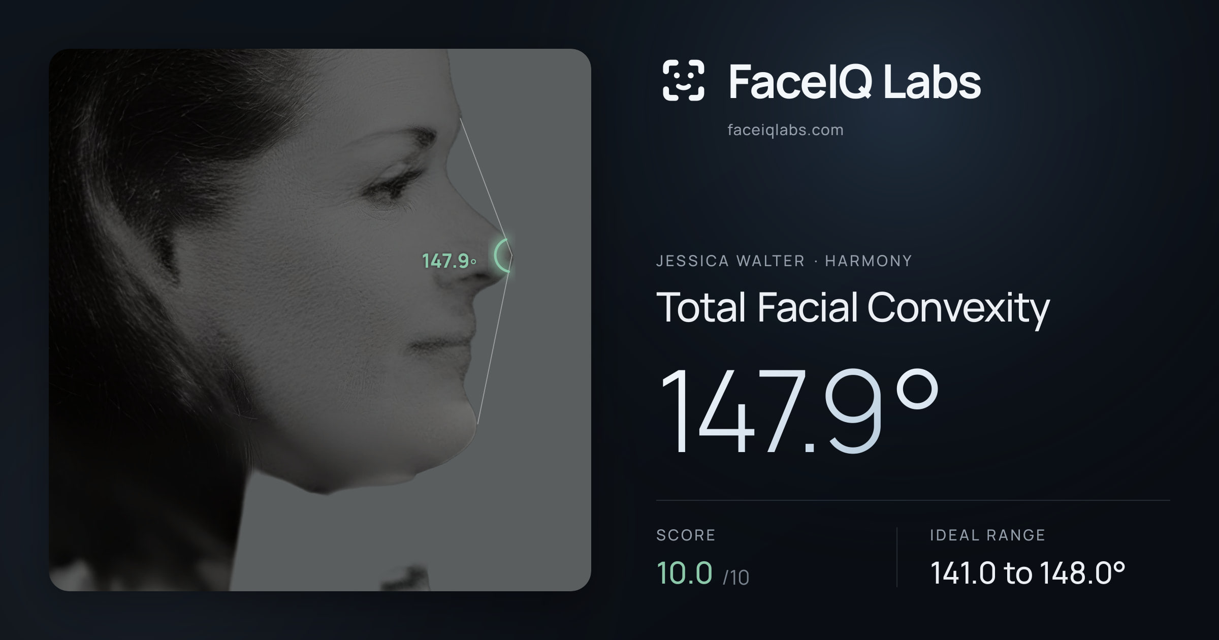 Jessica Walter Total Facial Convexity: 147.9°, drawn on the photo