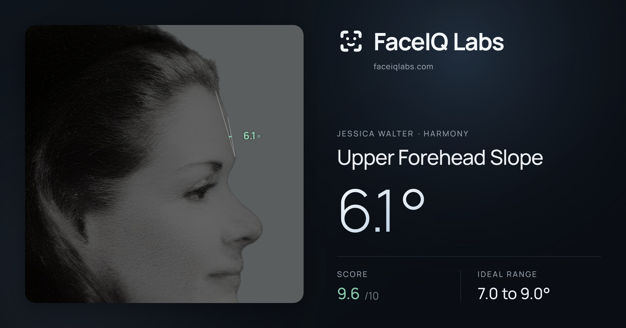 Jessica Walter Upper Forehead Slope: 6.1°, drawn on the photo