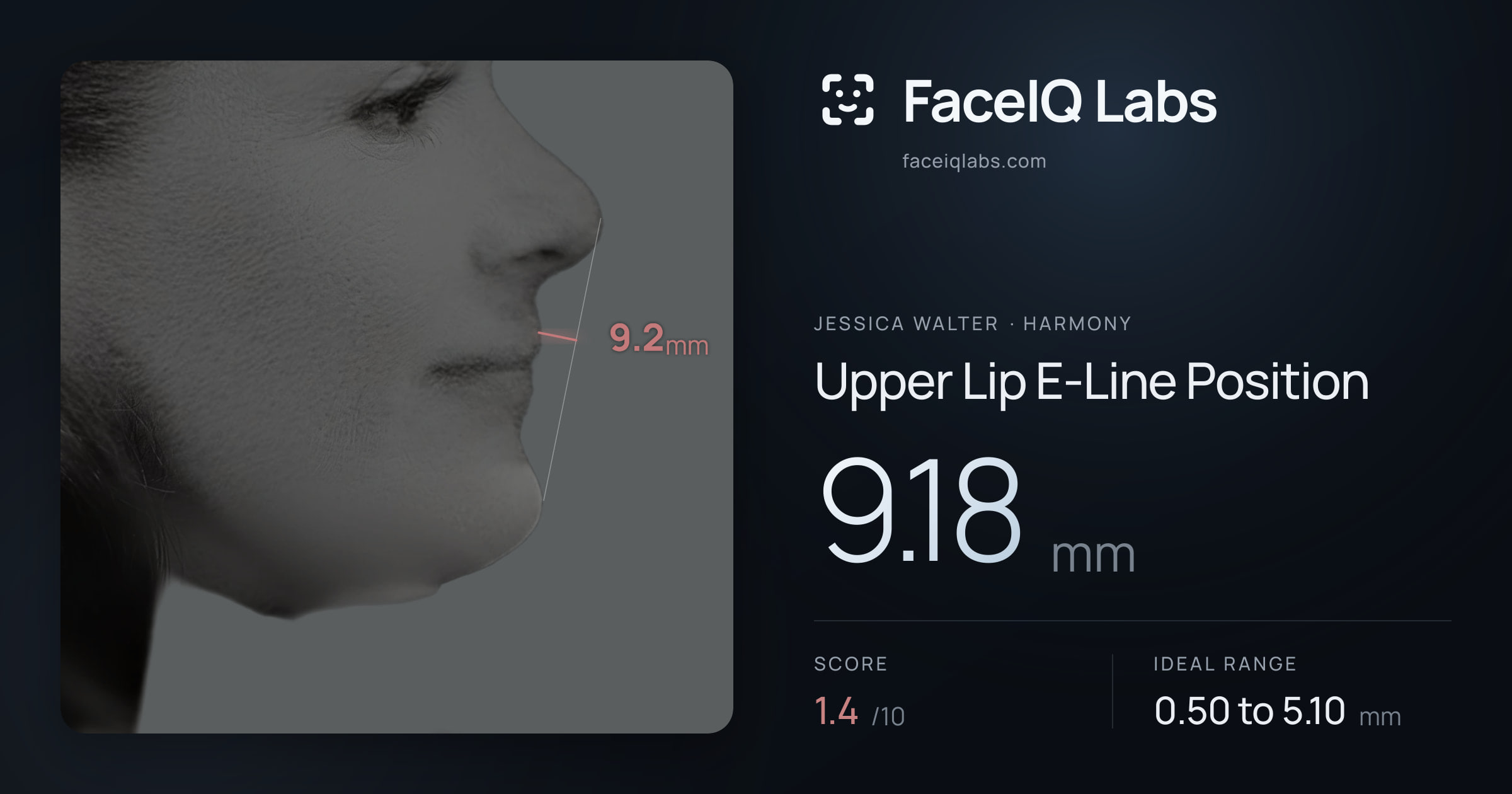 Jessica Walter Upper Lip E-Line Position: 9.18mm, drawn on the photo