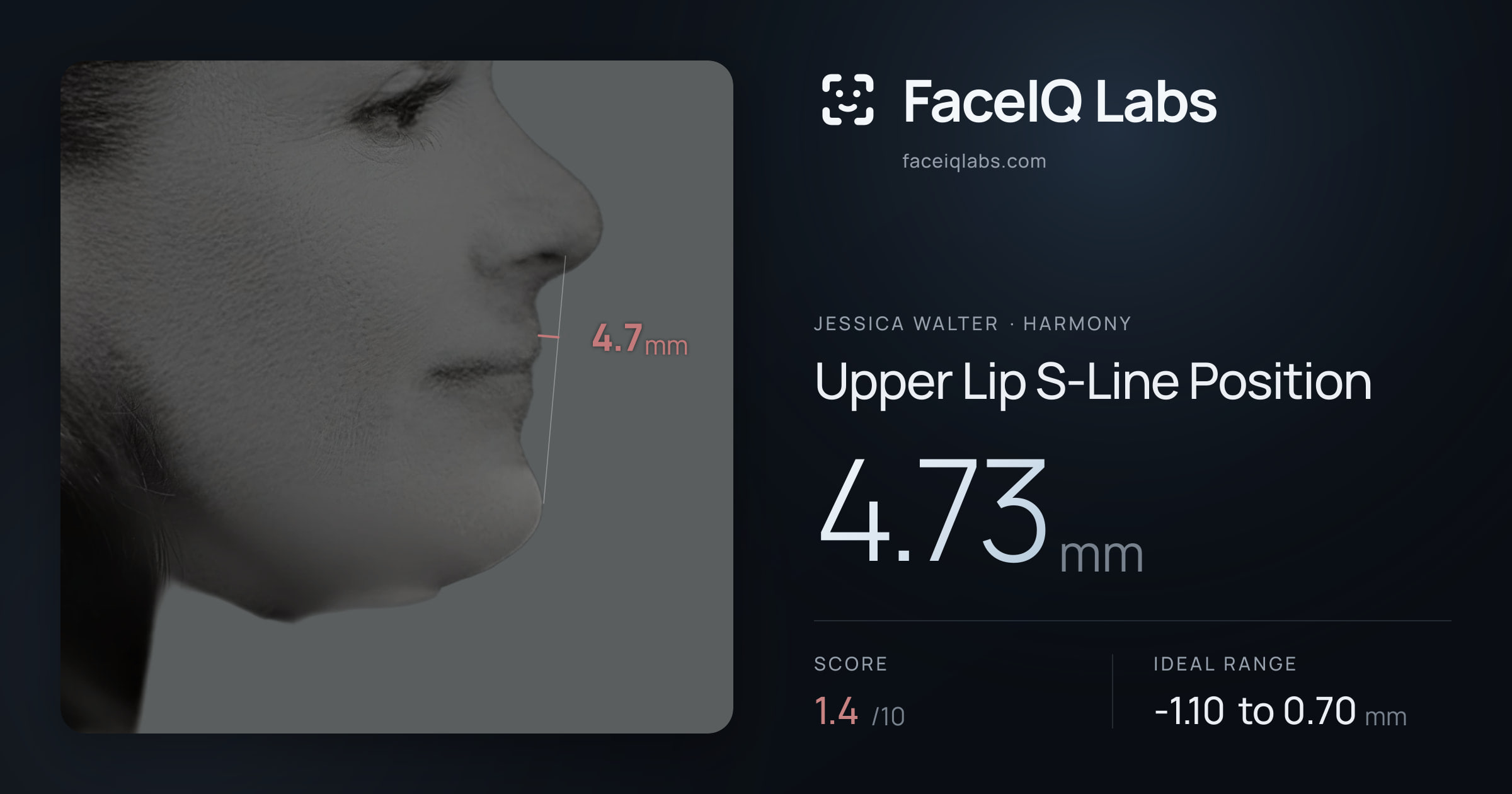 Jessica Walter Upper Lip S-Line Position: 4.73mm, drawn on the photo
