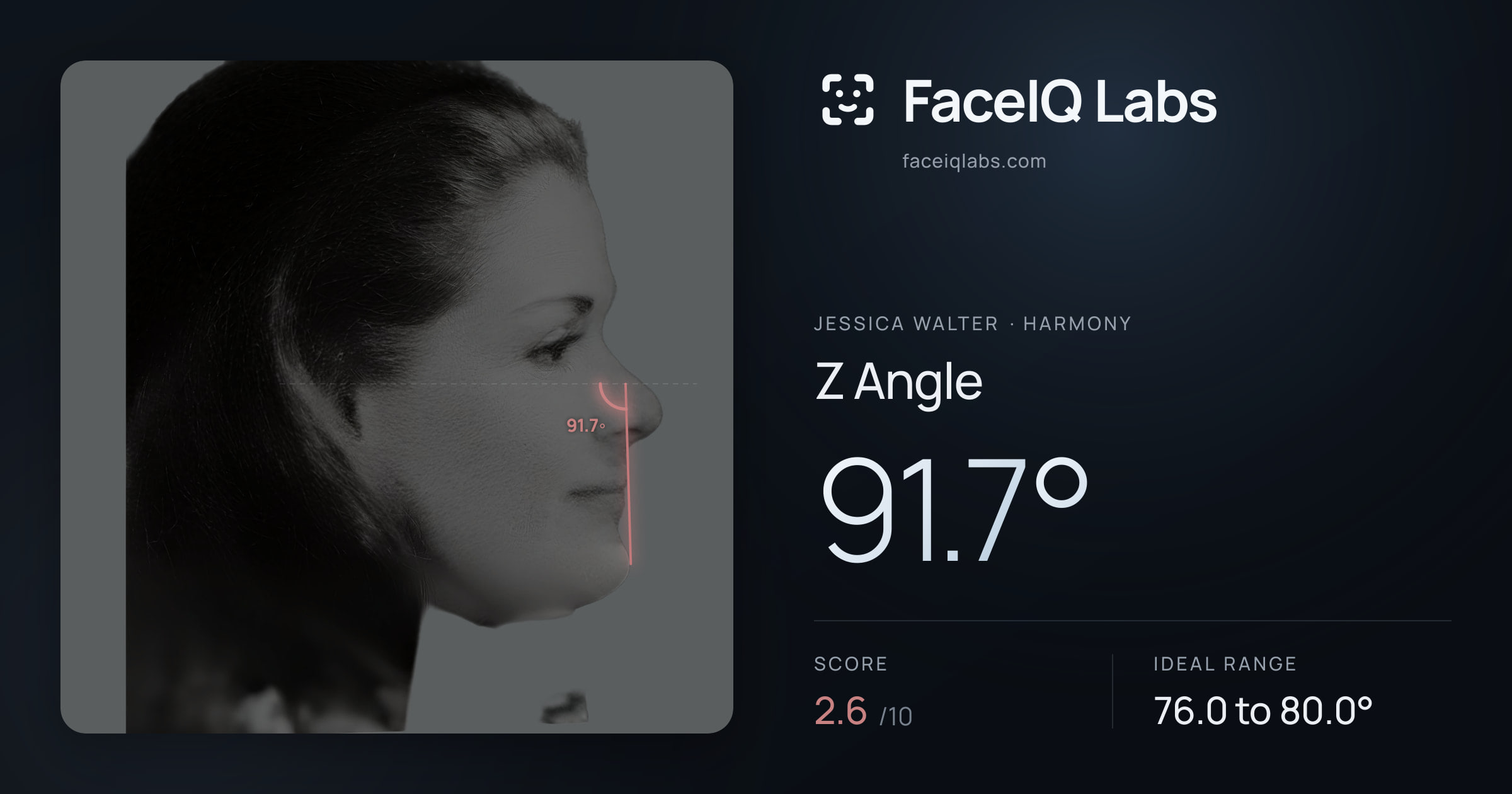 Jessica Walter Z Angle: 91.7°, drawn on the photo